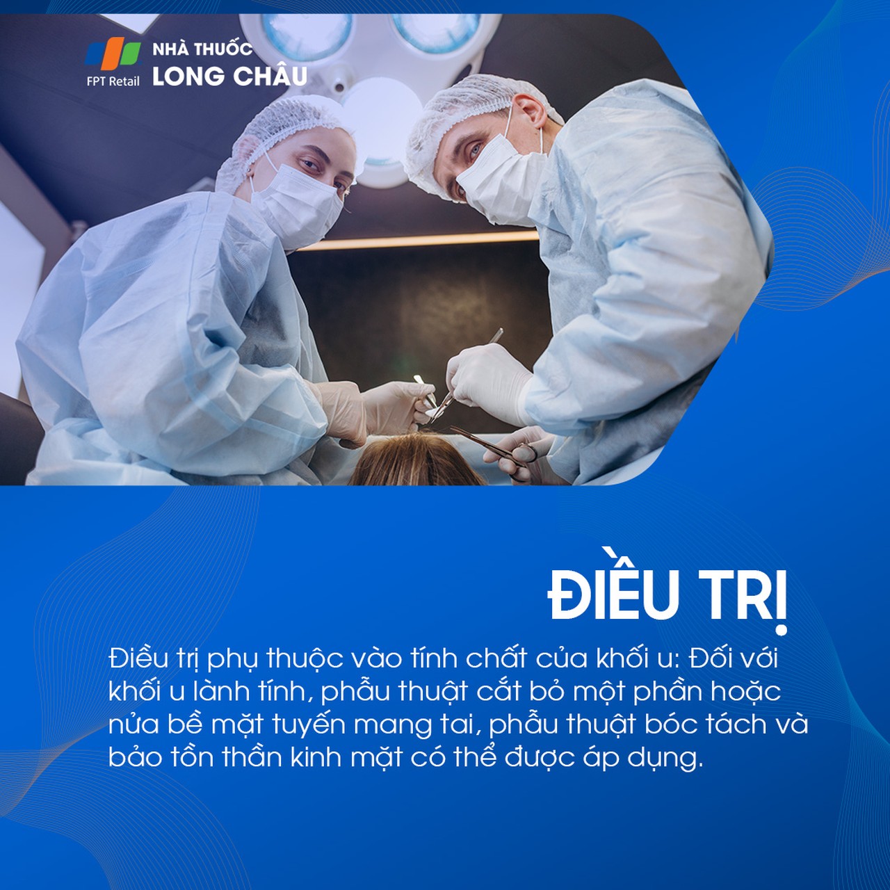 U tuyến nước bọt mang tai 8