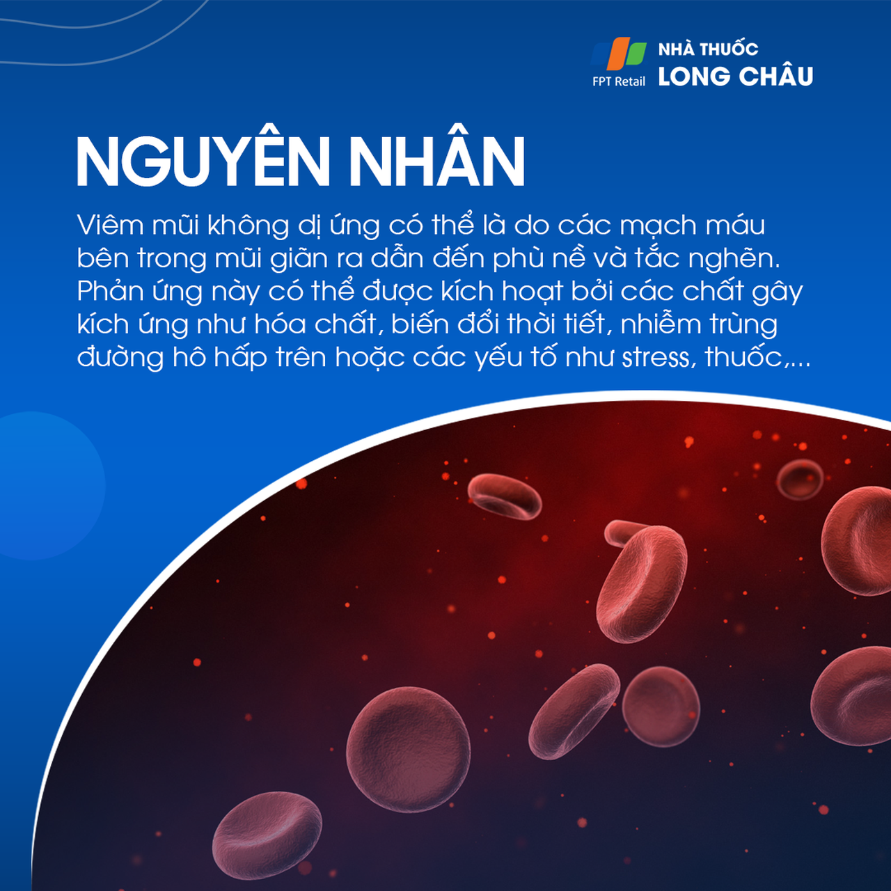 Viêm mũi mãn tính 4