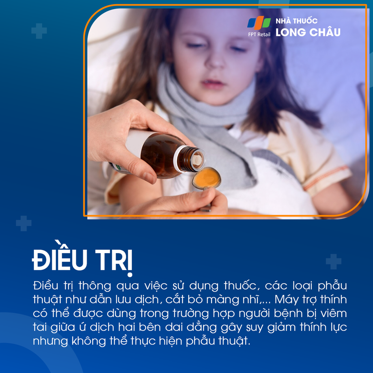 Viêm tai giữa ứ dịch 6