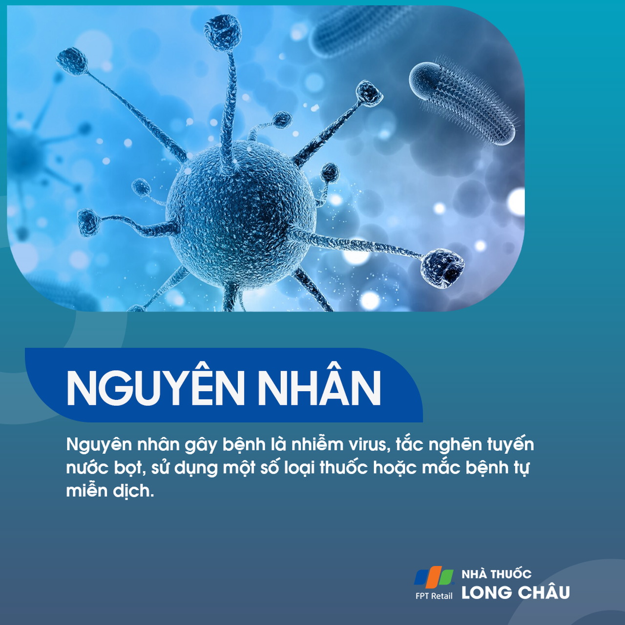 Viêm tuyến nước bọt 3