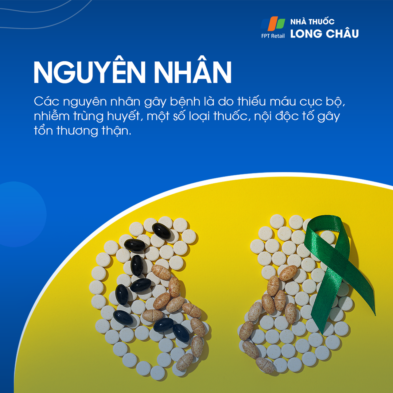 Hoại tử ống thận cấp 3