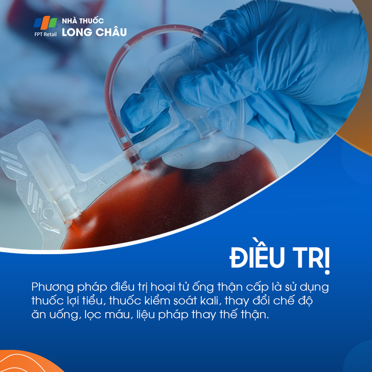 Hoại tử ống thận cấp 6