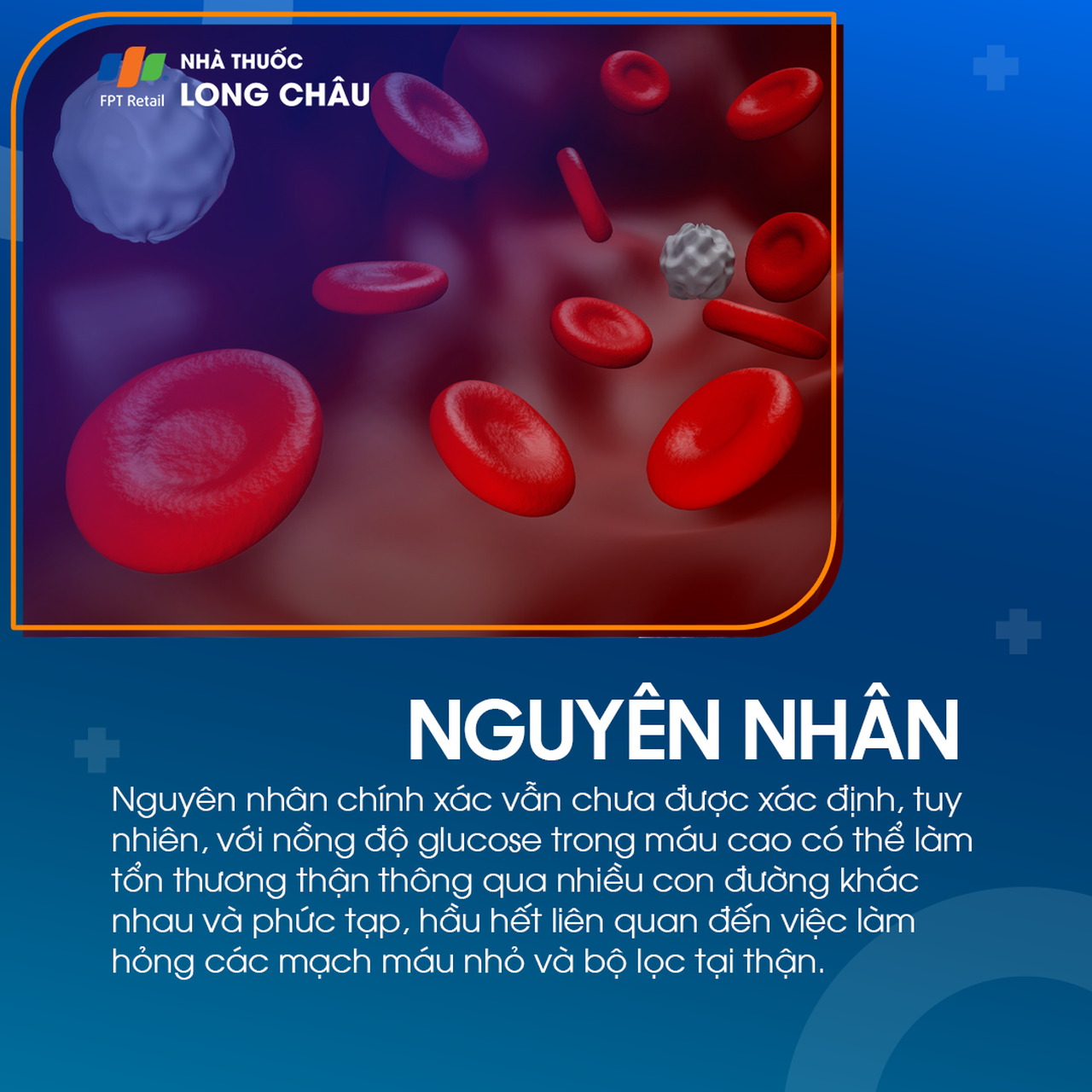 Thận đái tháo đường 3