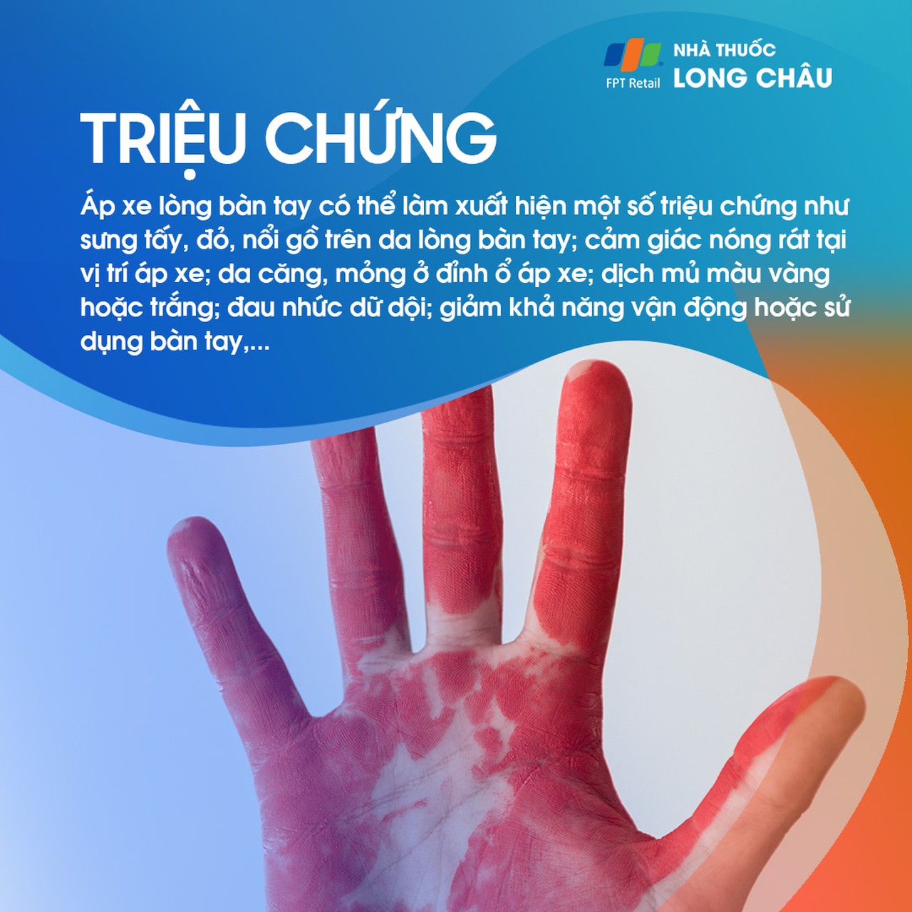 Áp xe lòng bàn tay 2