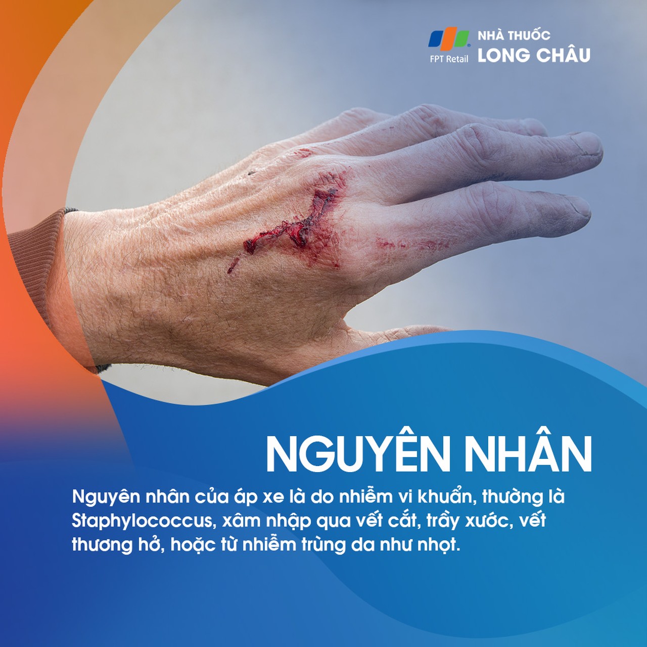 Áp xe lòng bàn tay 3