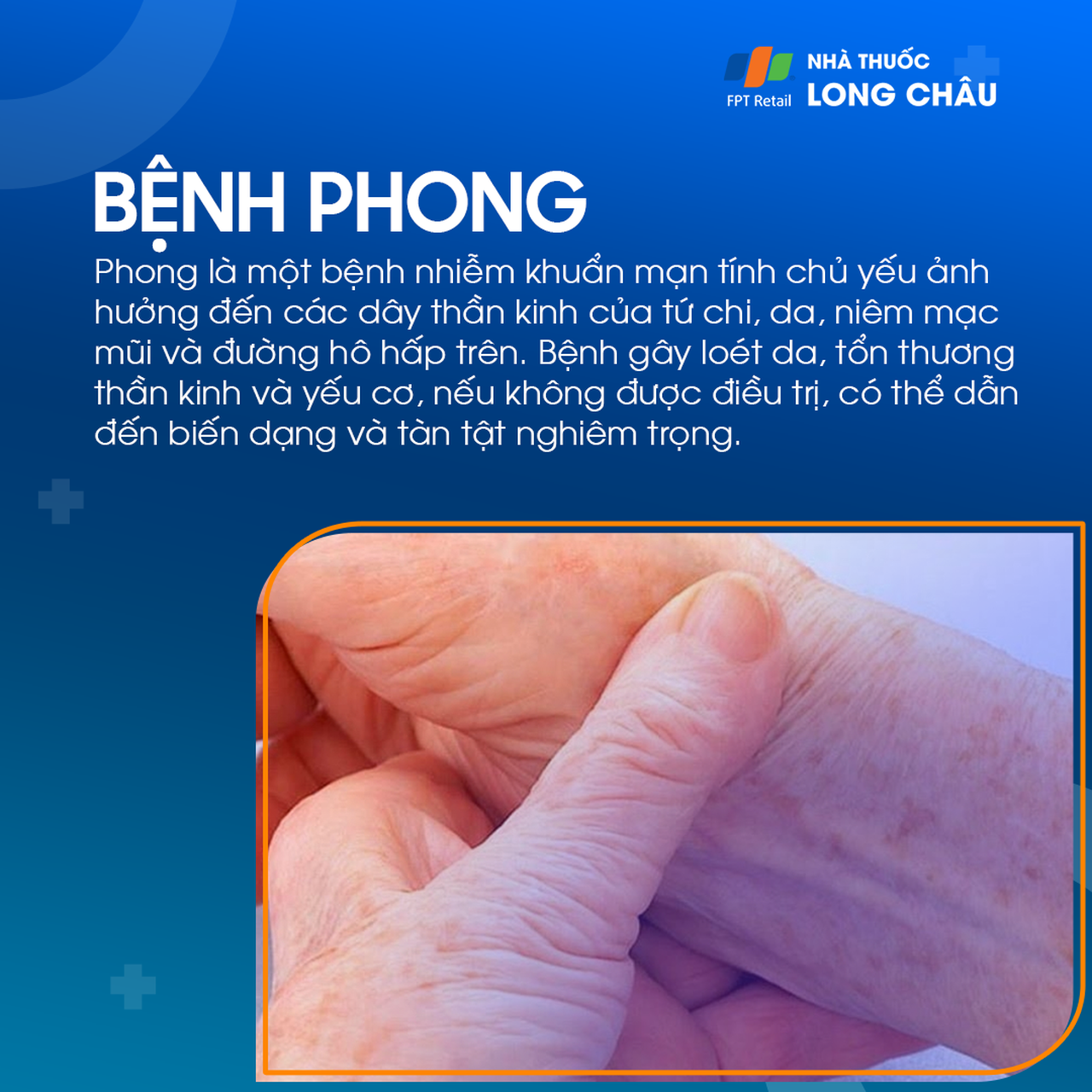 Phong 1