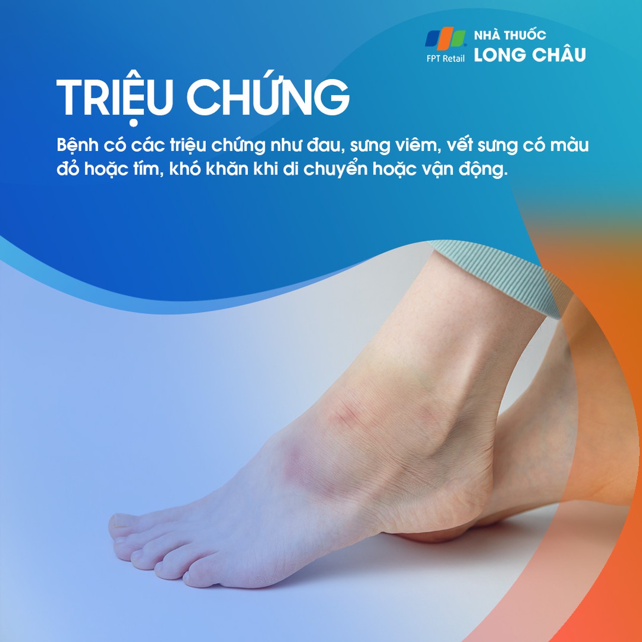 Bong gân cổ chân 2