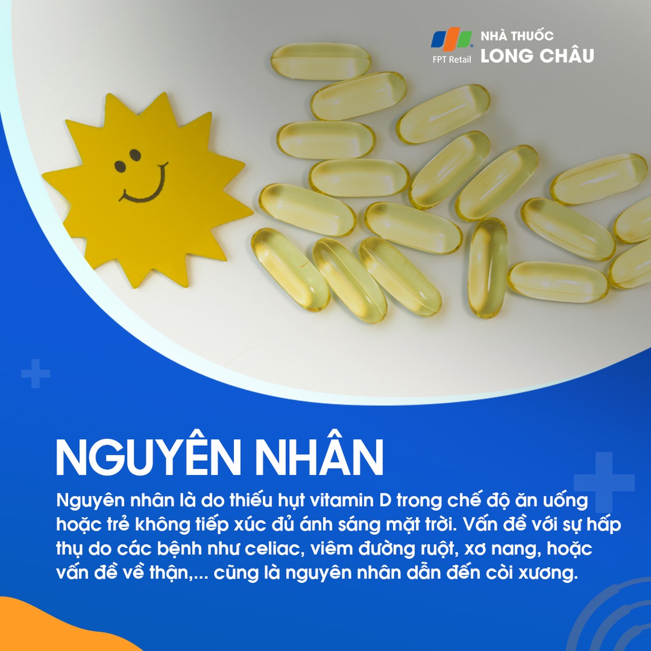 Còi xương do thiếu vitamin D, ít tiếp xúc nắng, hoặc kém hấp thu do bệnh tiêu hóa/thận