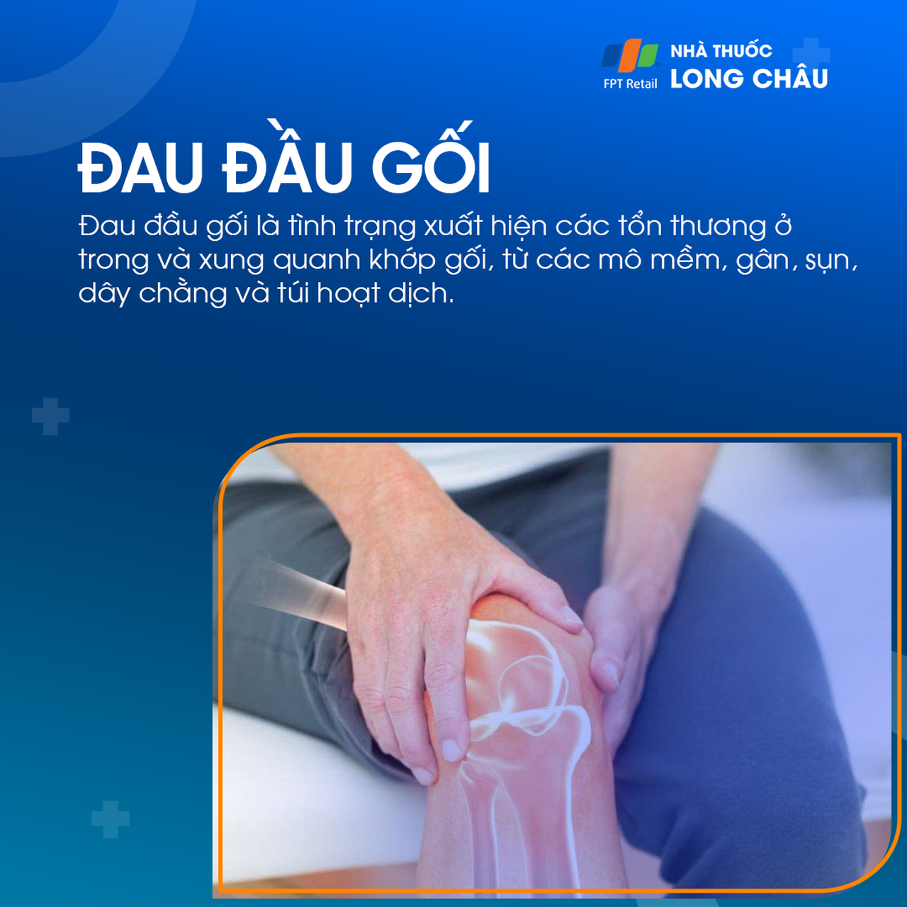 Đau đầu gối là tình trạng tổn thương các cấu trúc như gân, sụn, dây chằng hoặc bao hoạt dịch quanh khớp gối, gây ảnh hưởng đến vận động