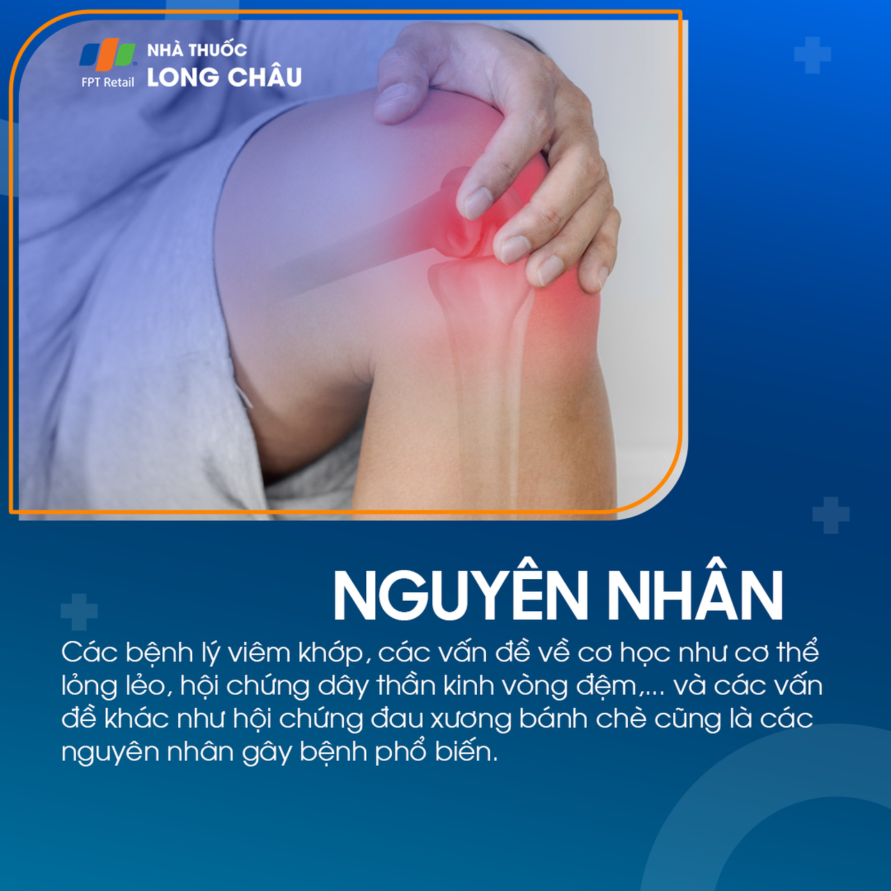 Các bệnh lý như viêm khớp, cơ học bất thường, hội chứng dây thần kinh hoặc đau xương bánh chè là nguyên nhân phổ biến gây đau đầu gối