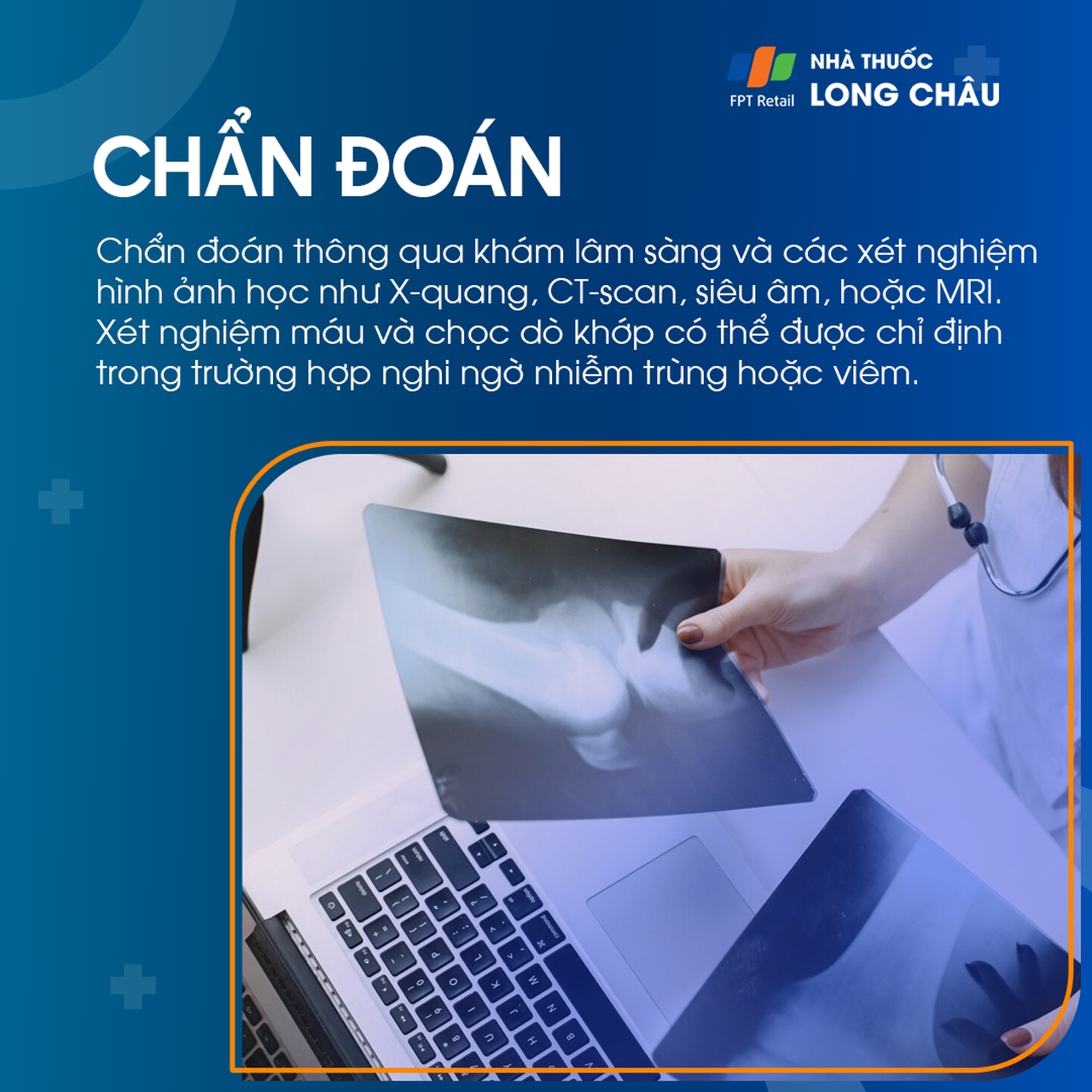 Đau đầu gối được chẩn đoán bằng khám lâm sàng, hình ảnh học như X-quang, MRI và các xét nghiệm máu, dịch khớp nếu nghi ngờ viêm/nhiễm trùng