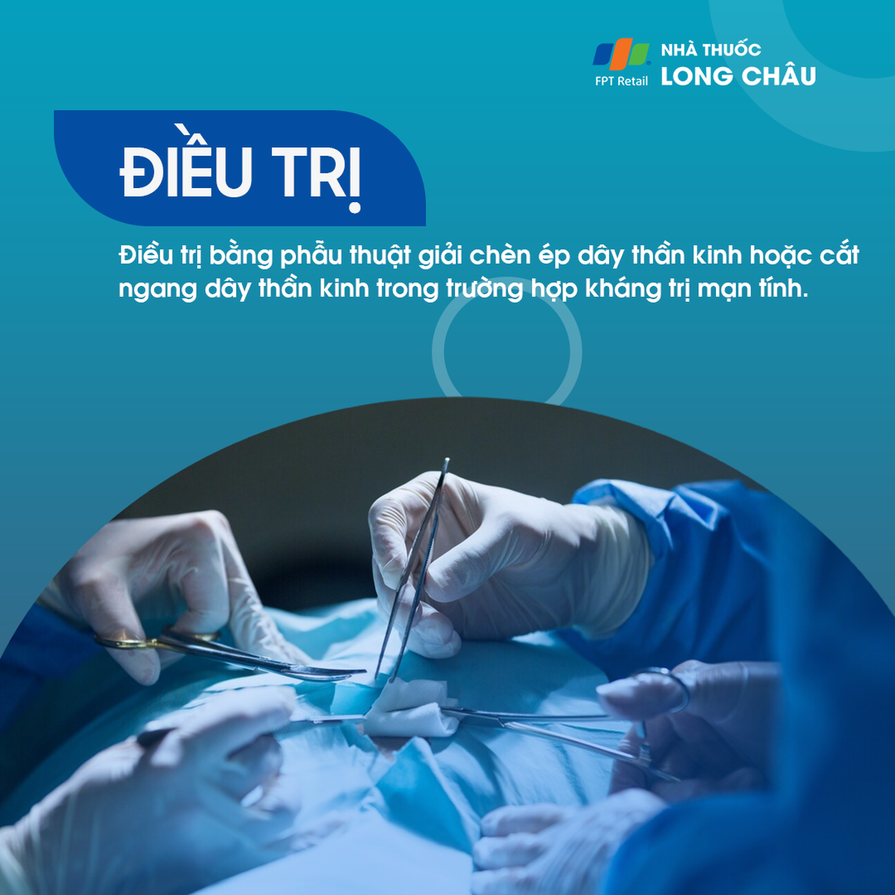 Đau đùi dị cảm 8