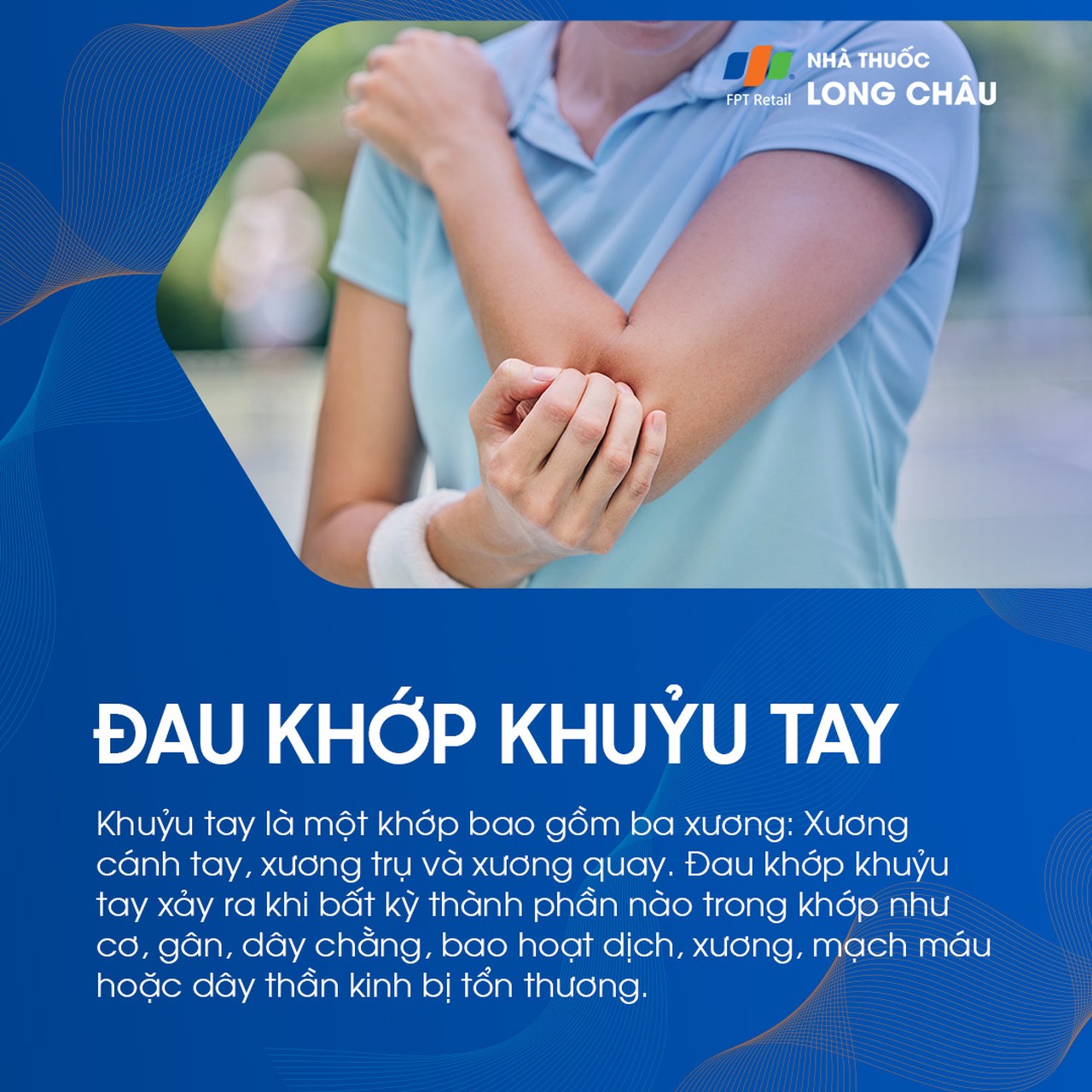 Đau khớp khuỷu tay khi có tổn thương bất kỳ thành phần nào của khớp bao gồm cơ, gân, dây chằng, bao hoạt dịch, xương, mạch máu hoặc dây thần kinh