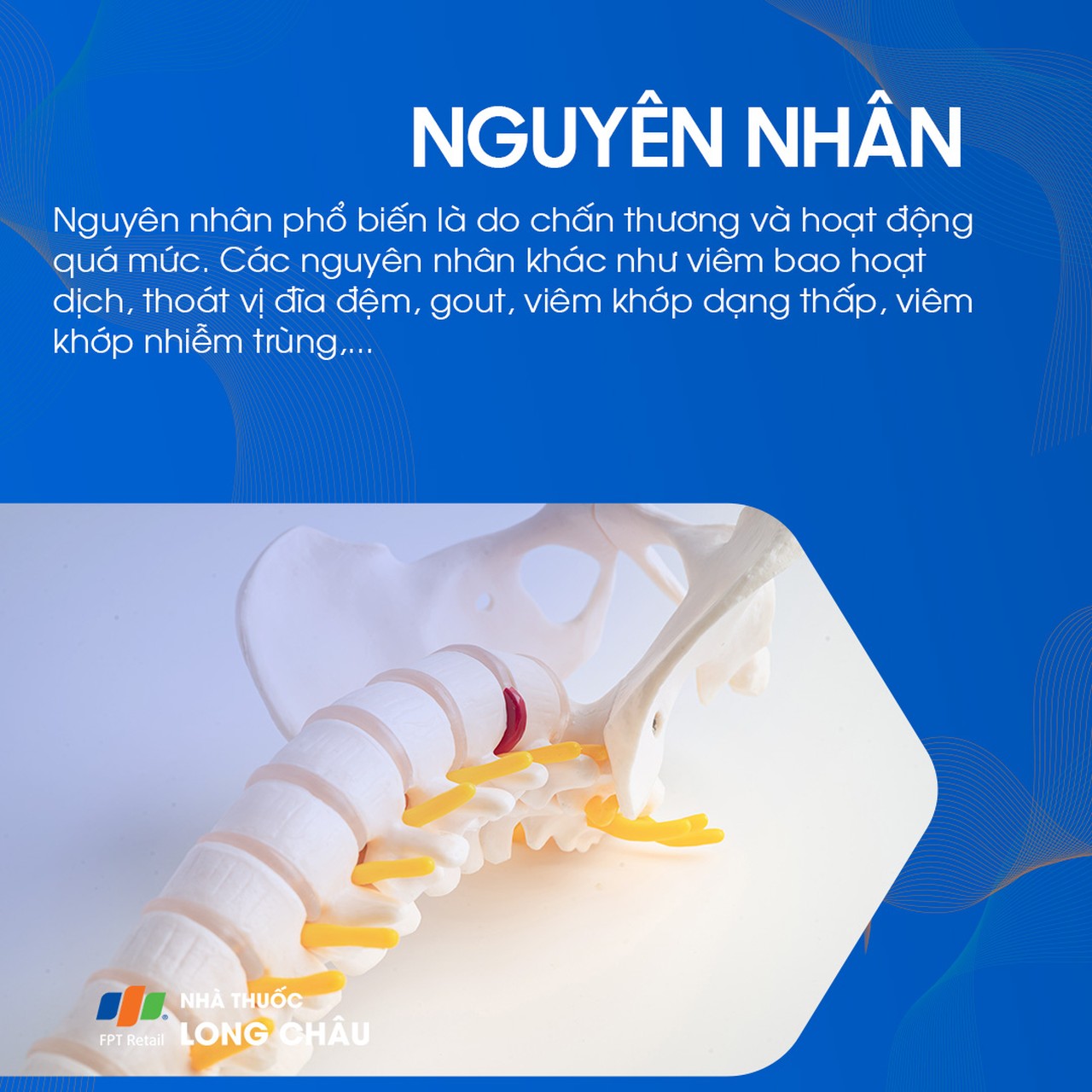 Nguyên nhân gây đau khớp khuỷu tay: Ảnh hưởng từ việc lặp đi lặp lại các động tác tay