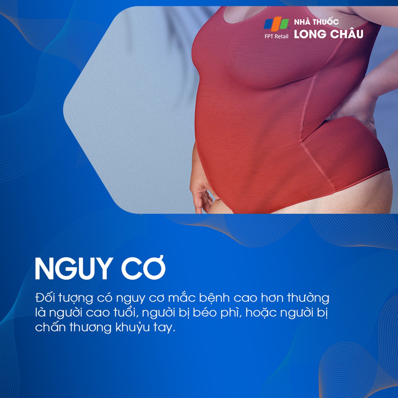 Đối tượng nguy cơ cao mắc đau khớp khuỷu tay: Vận động viên và người làm việc văn phòng