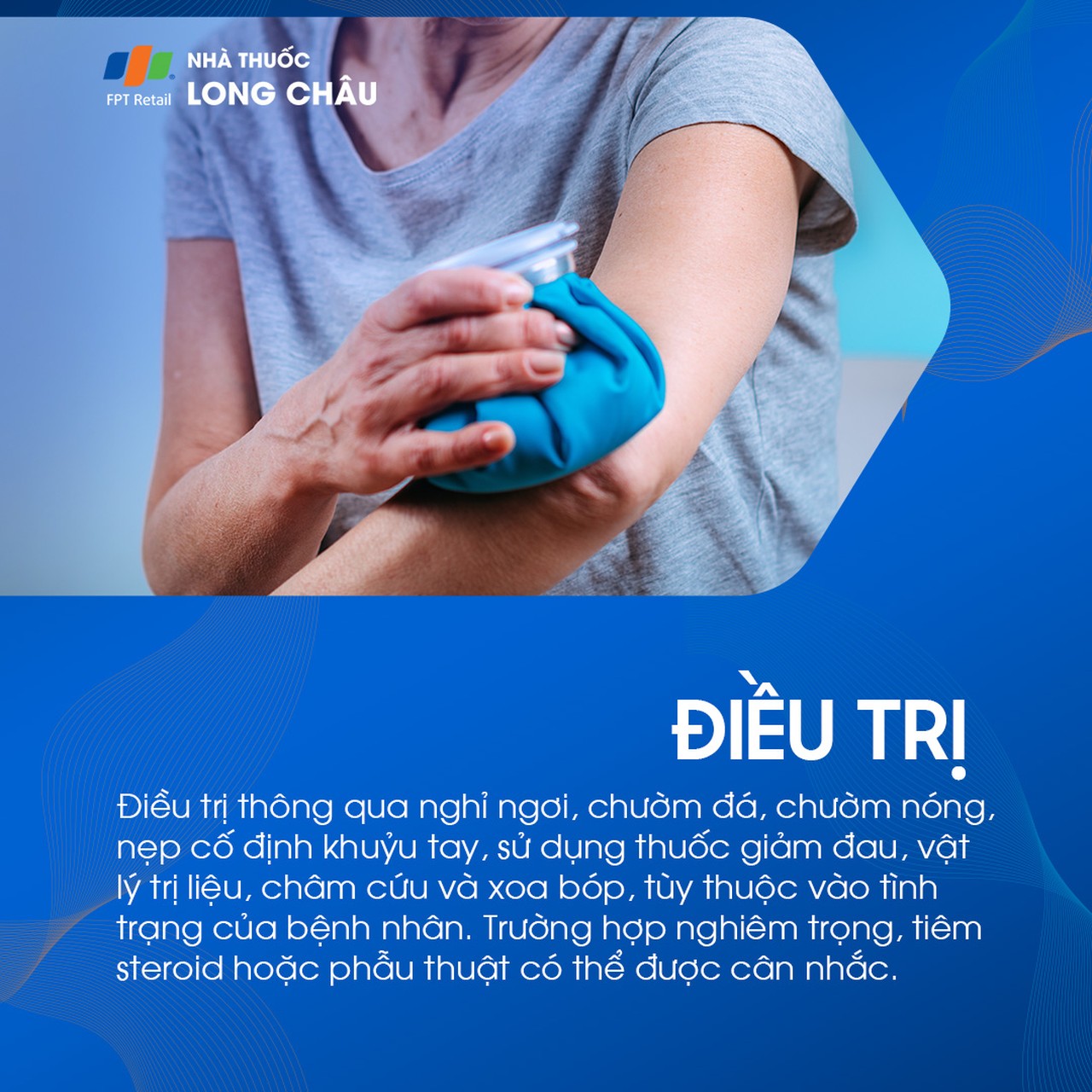 Điều trị đau khớp khuỷu tay bằng cách thực hiện vật lý trị liệu 