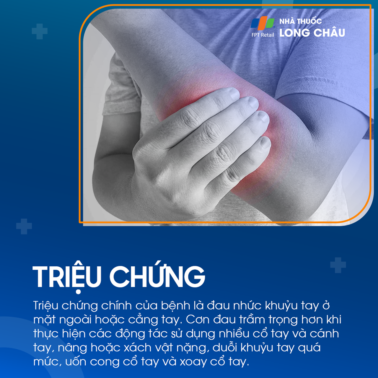 Hội chứng đường hầm xương quay 2