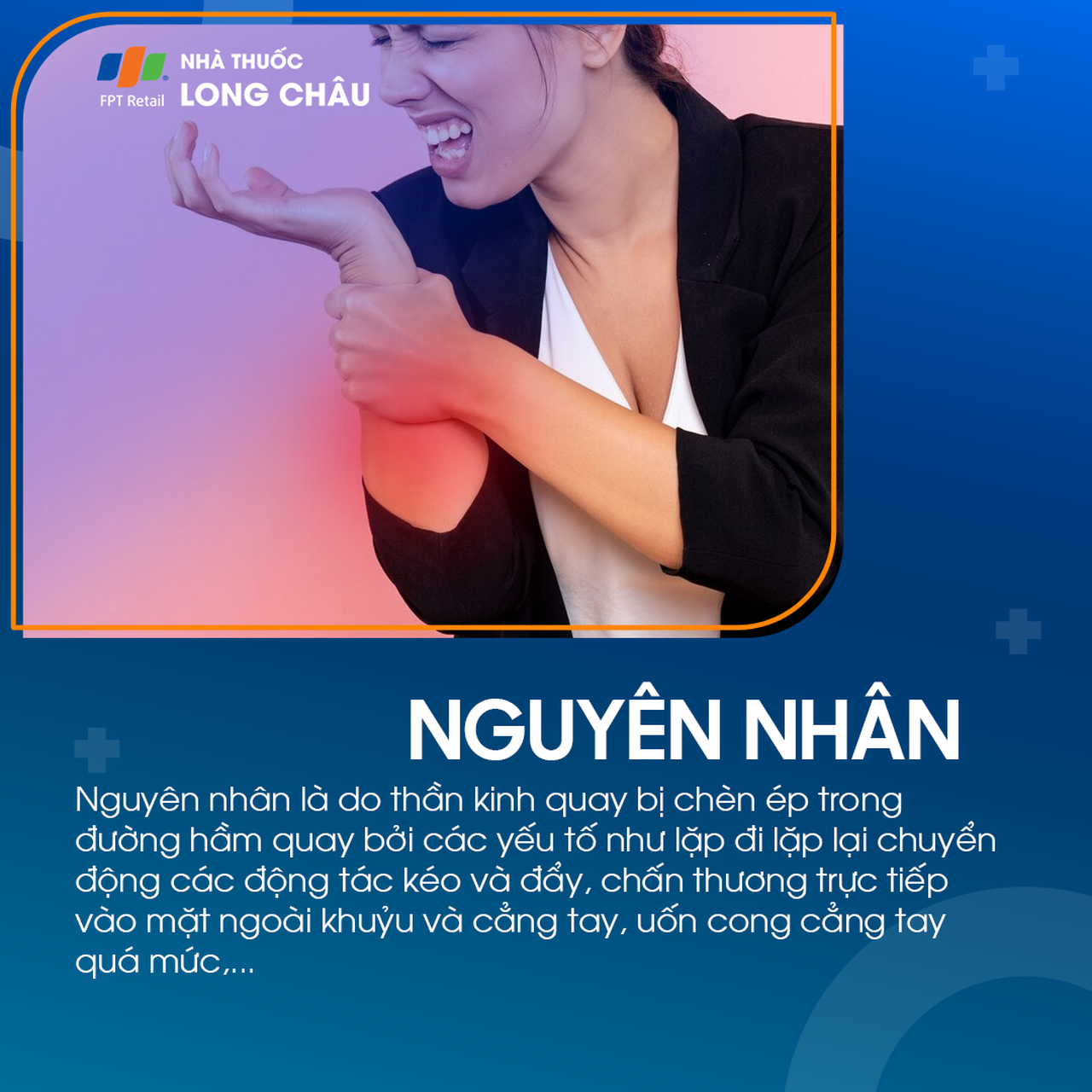 Hội chứng đường hầm xương quay 3