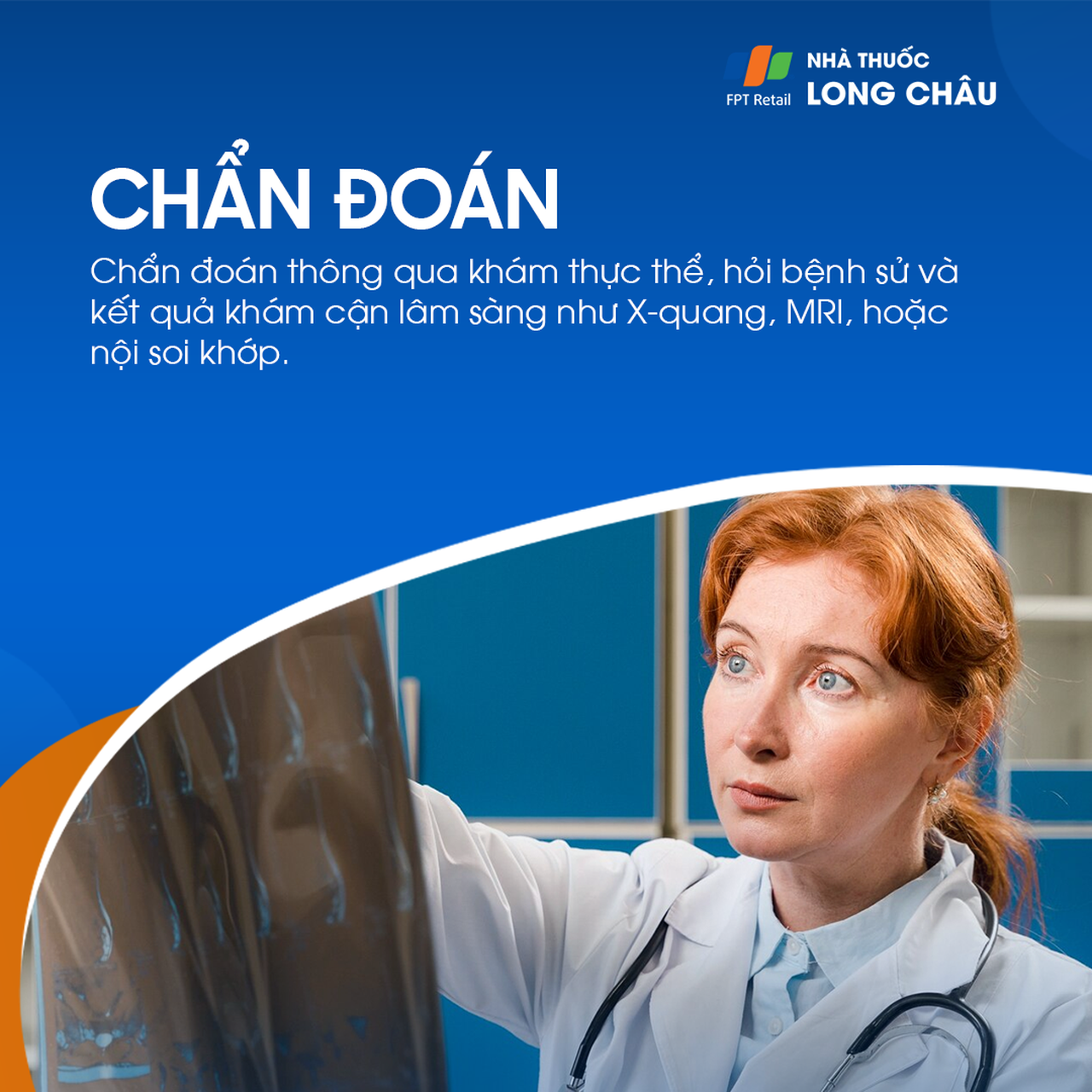 Đứt dây chằng 6