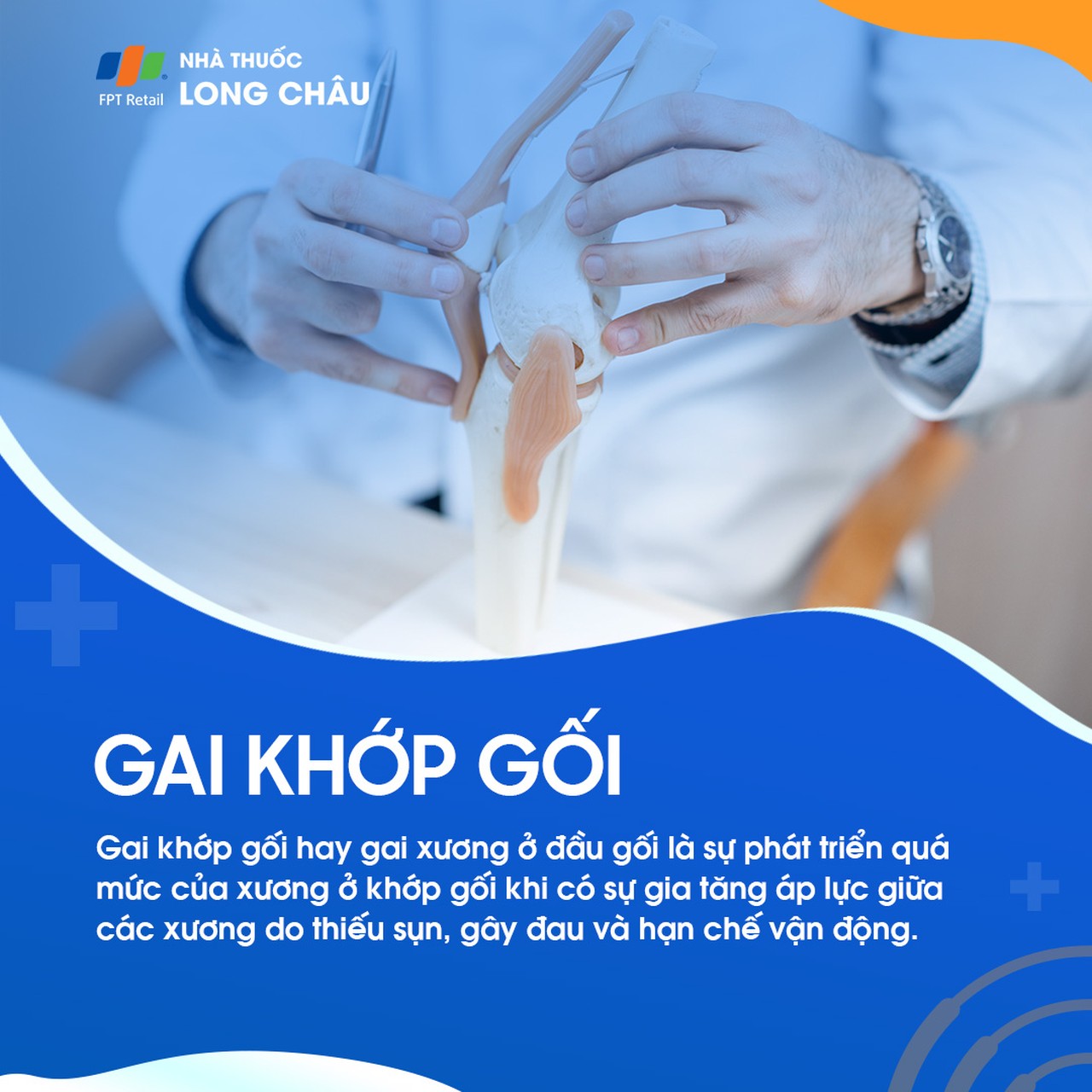 Gai khớp gối 1