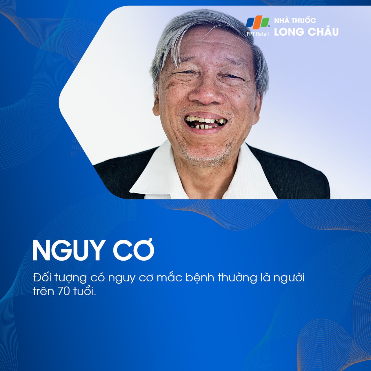 Hẹp động mạch chi dưới 4