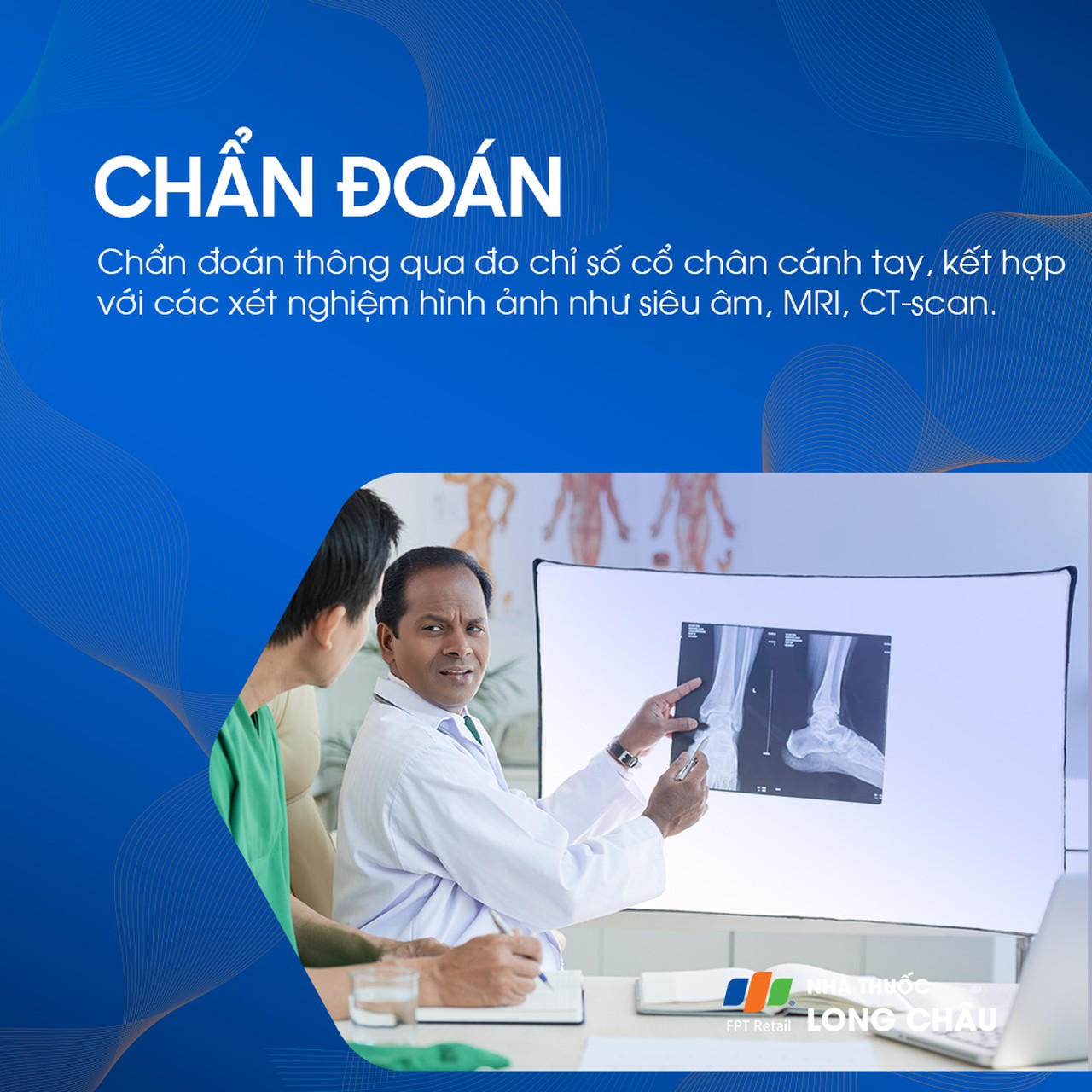 Hẹp động mạch chi dưới 5