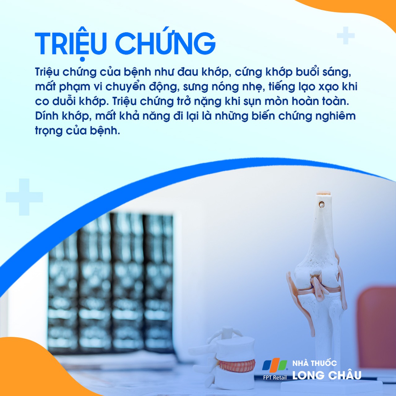 Hẹp khe khớp gối 2