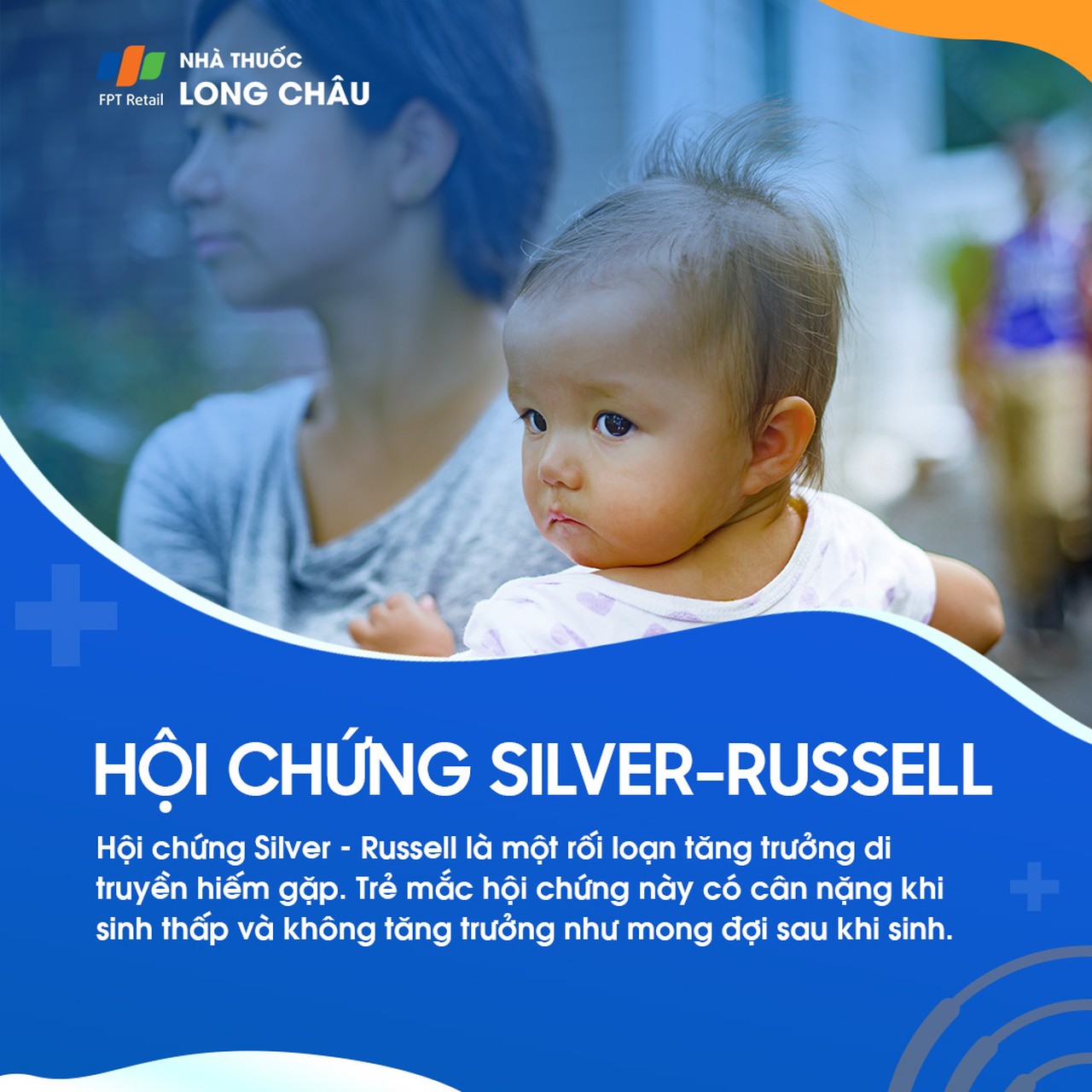 Hội chứng Silver - Russell 1