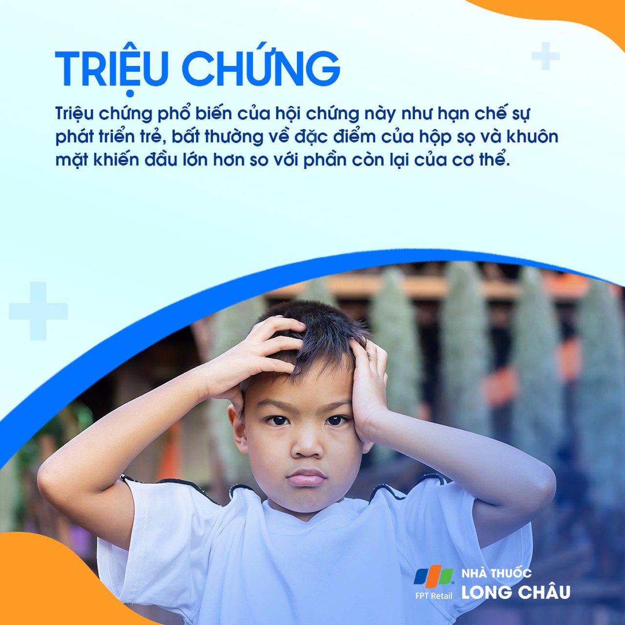 Hội chứng Silver - Russell 2