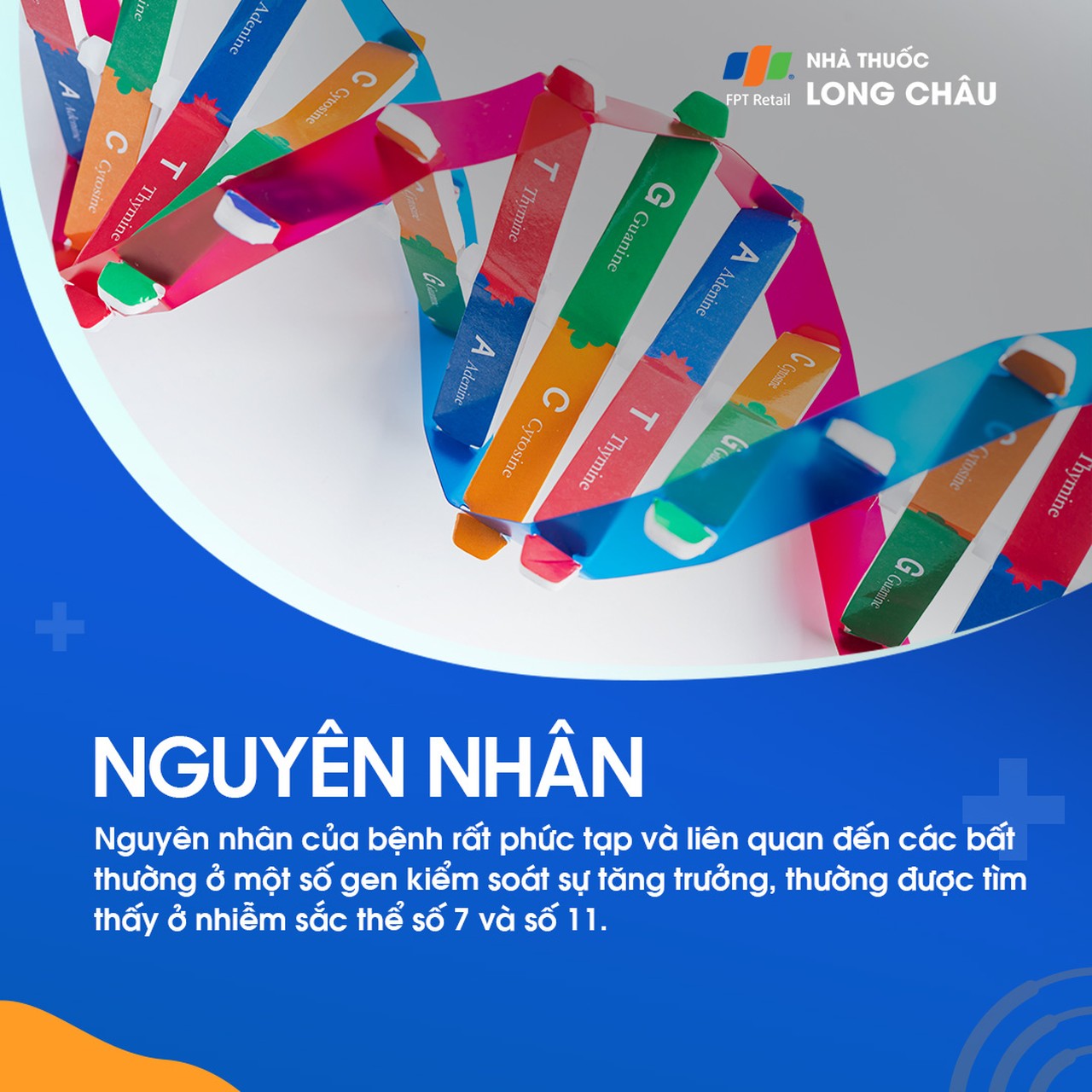 Hội chứng Silver - Russell 4