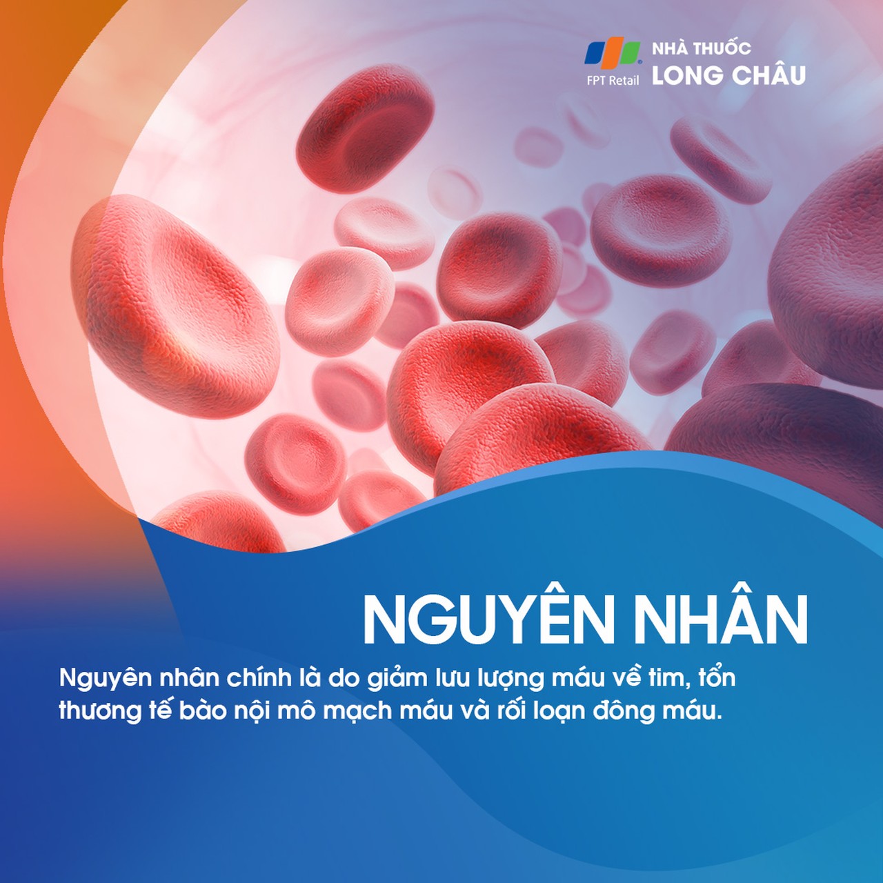 Huyết khối tĩnh mạch sâu chi dưới 3