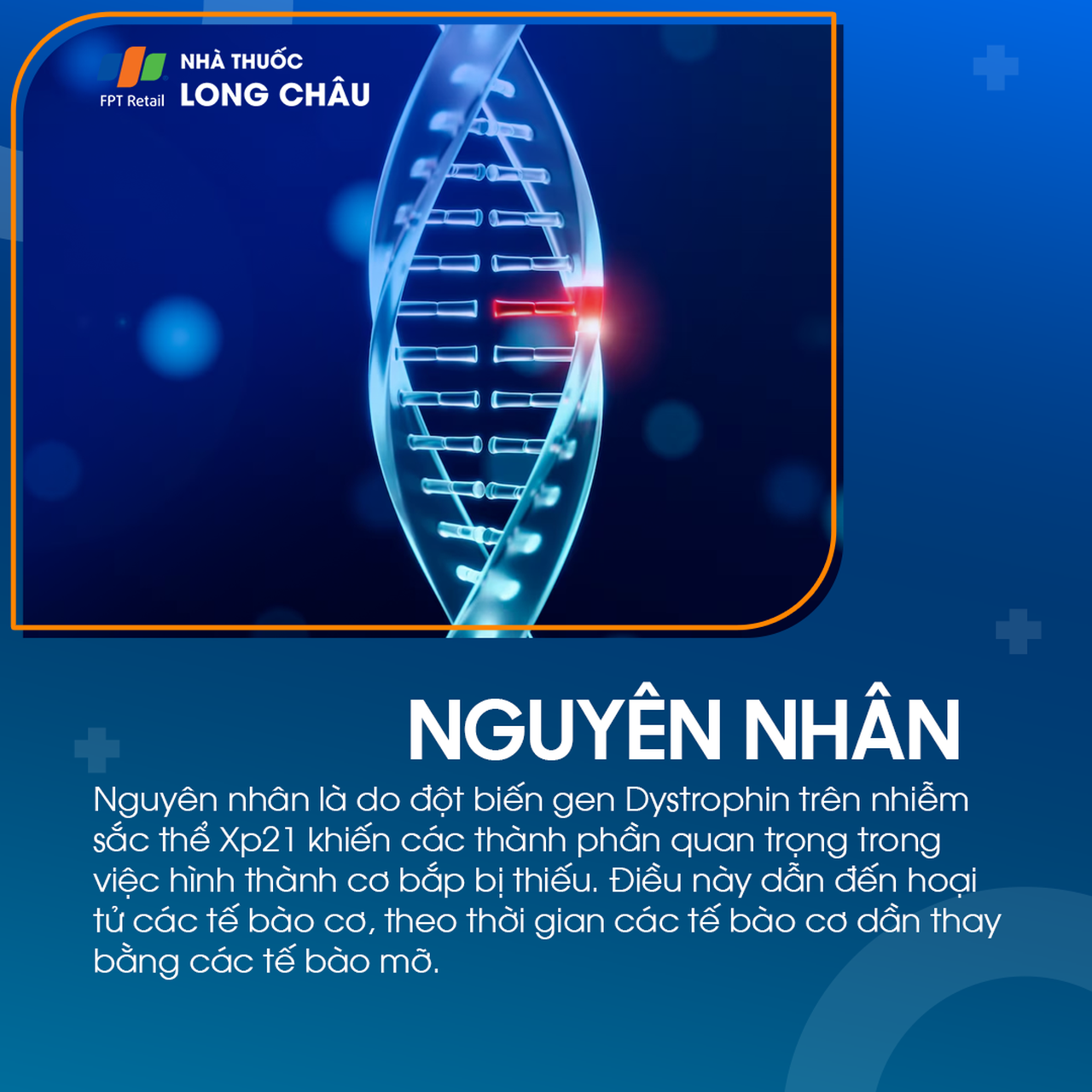 Loạn dưỡng cơ Duchenne 3