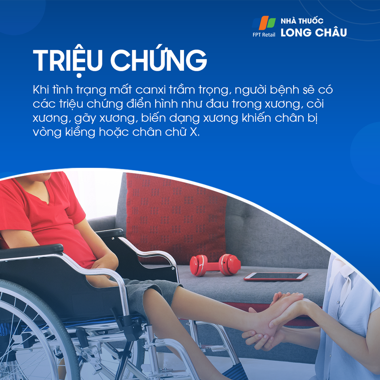 Loạn dưỡng xương 3