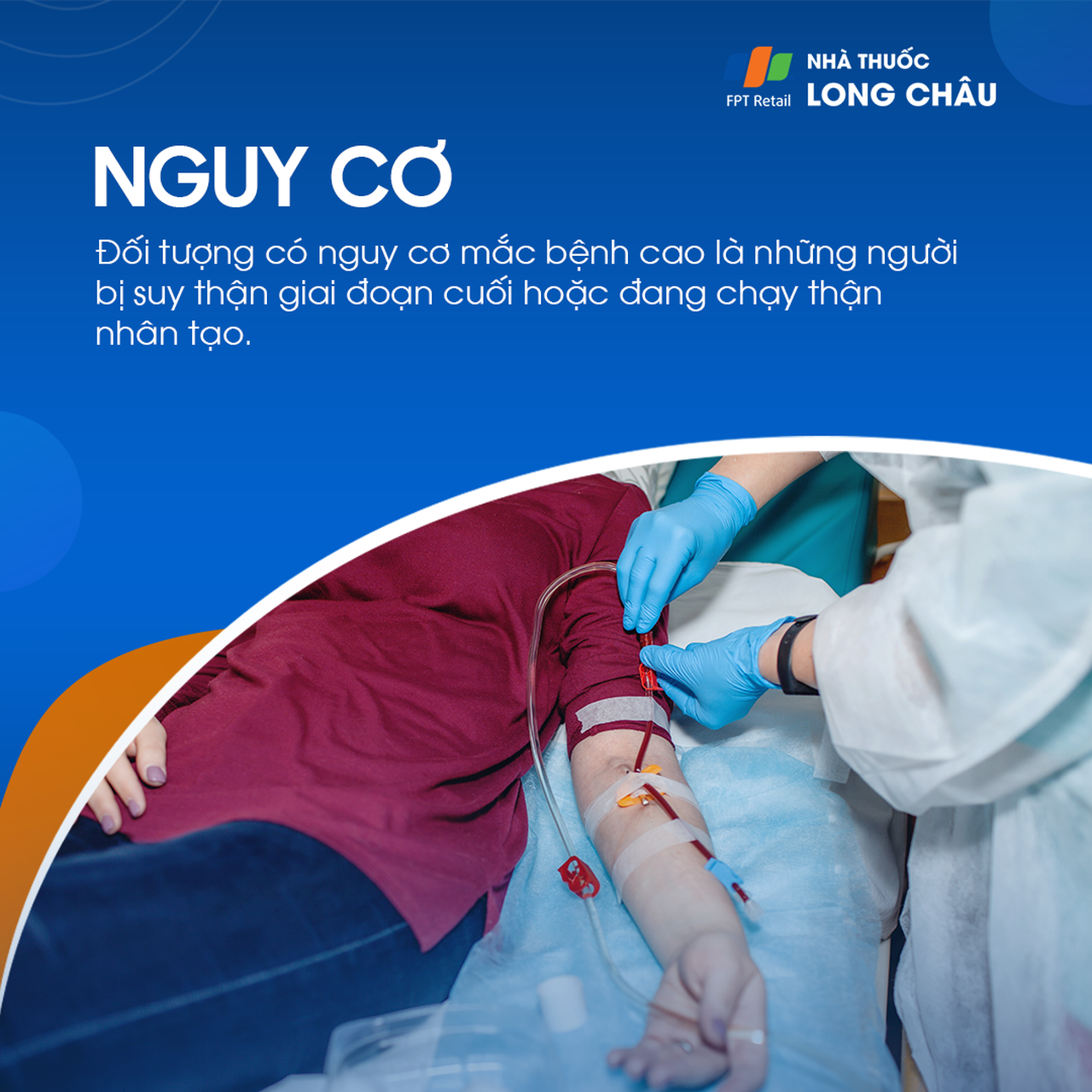 Loạn dưỡng xương 5