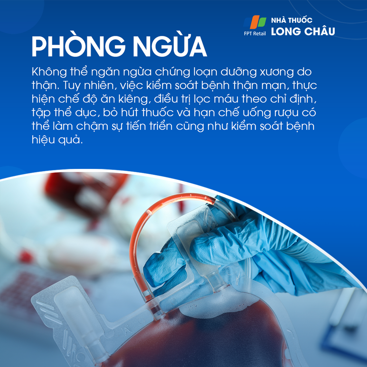 Loạn dưỡng xương 8