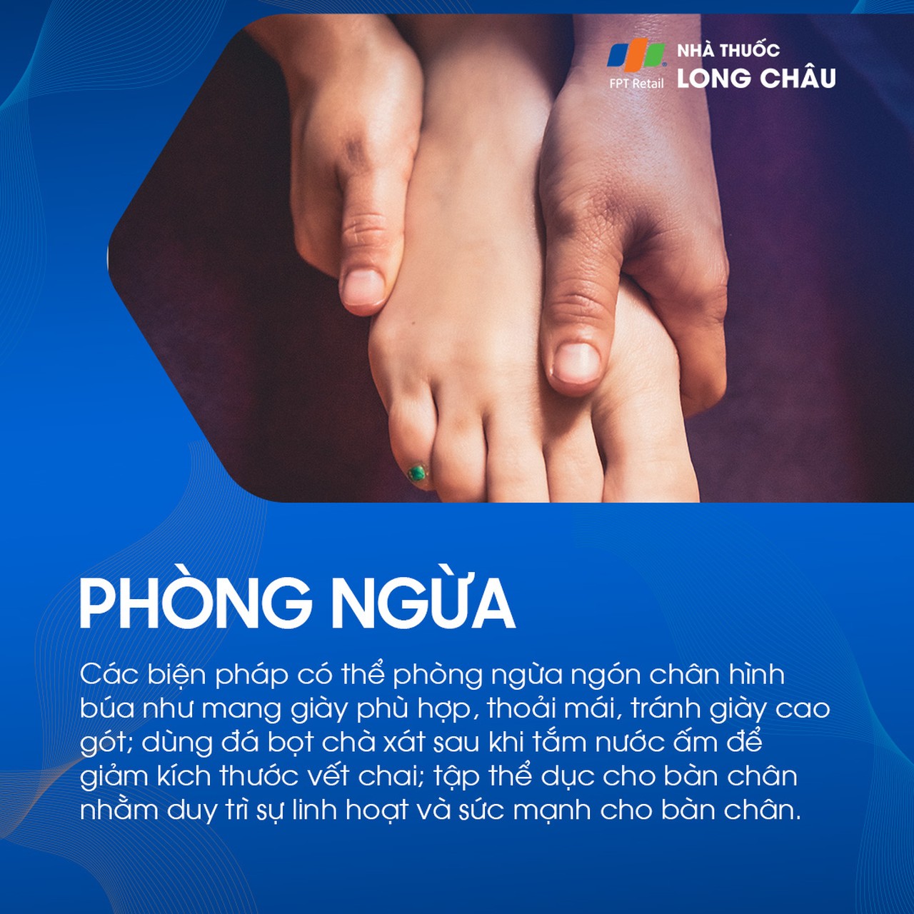 Ngón chân hình búa 8