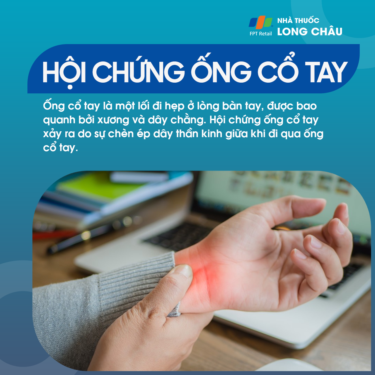 Hội chứng ống cổ tay 1