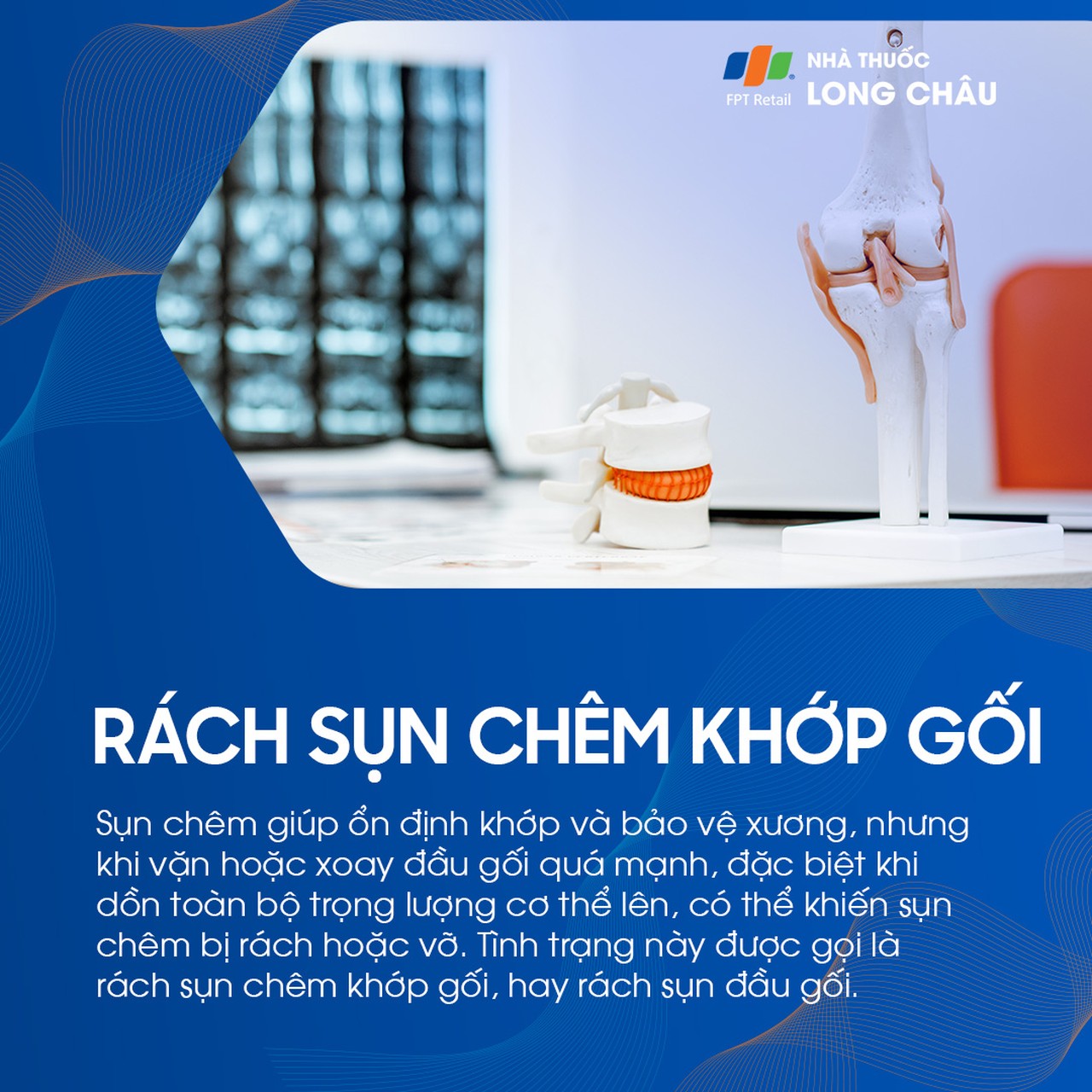 Rách sụn chêm khớp gối 1