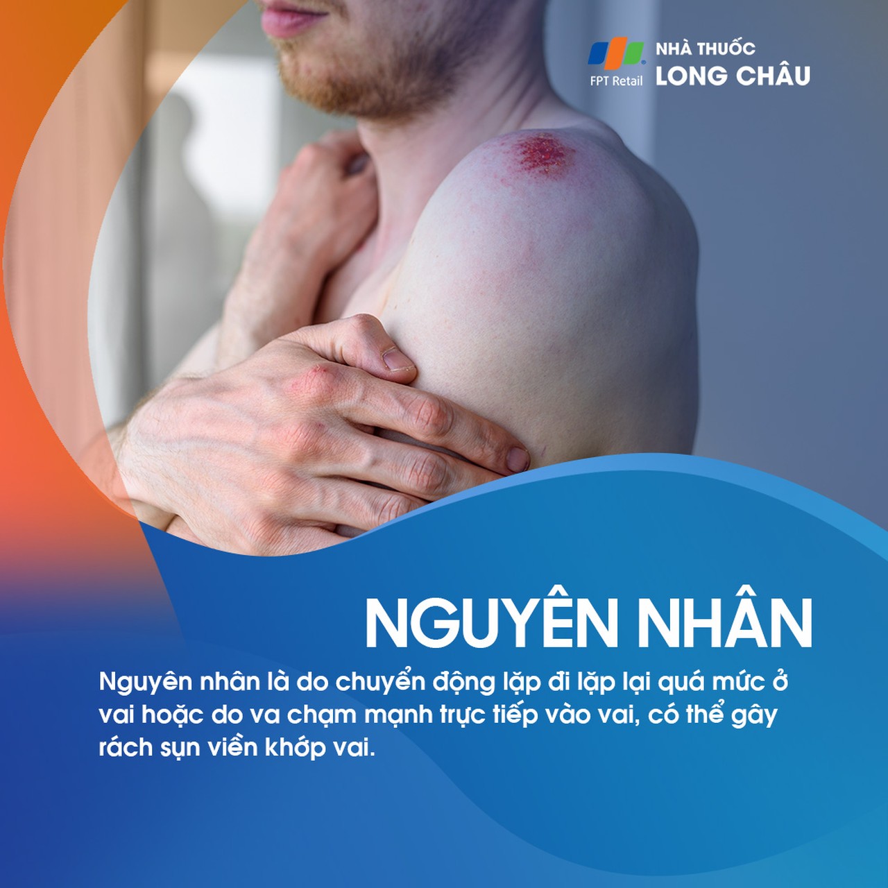 Rách sụn viền khớp vai 3