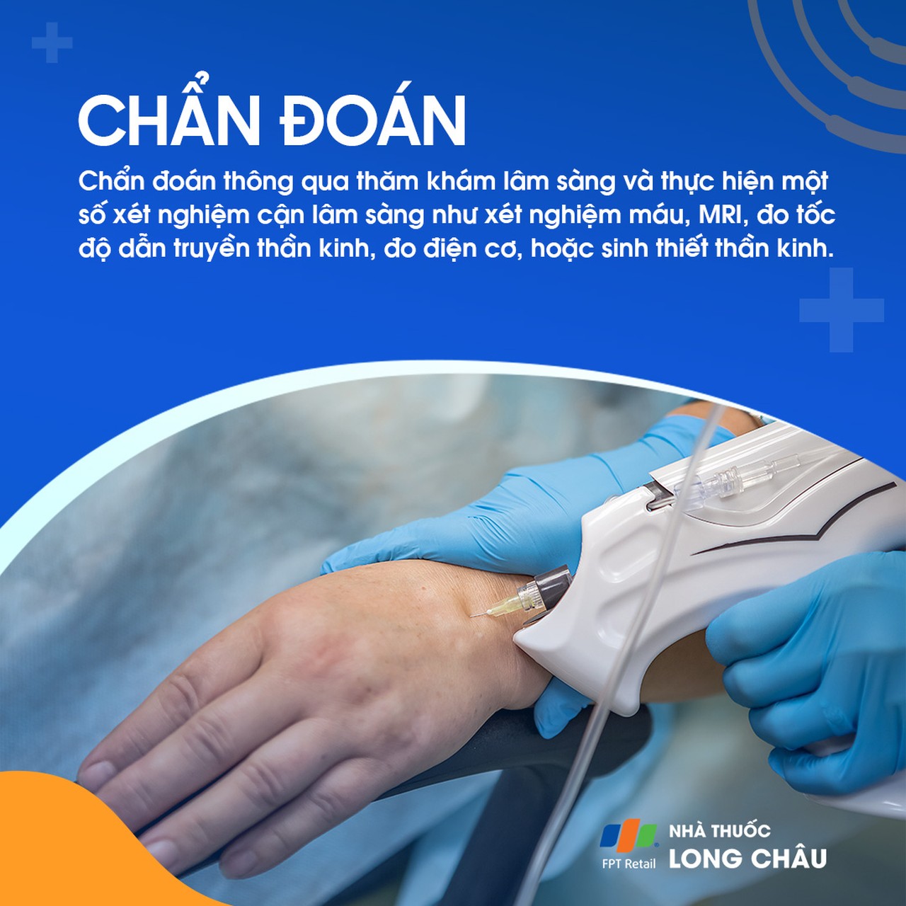 Rối loạn dây thần kinh trụ 6