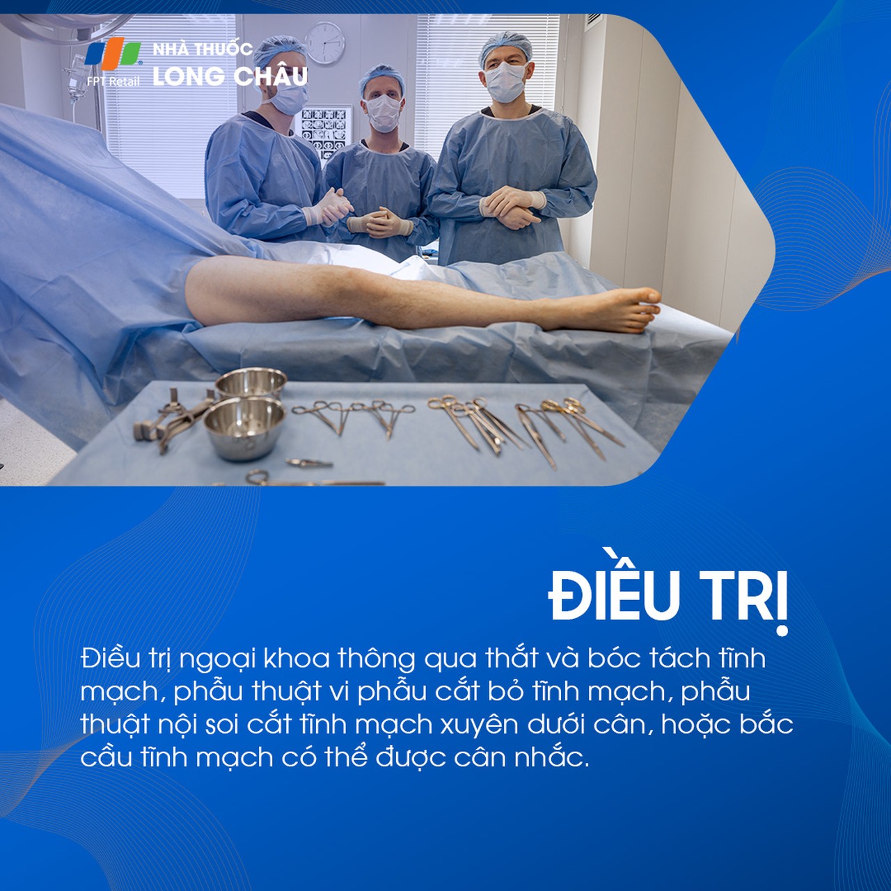 Suy giãn tĩnh mạch chi dưới 7