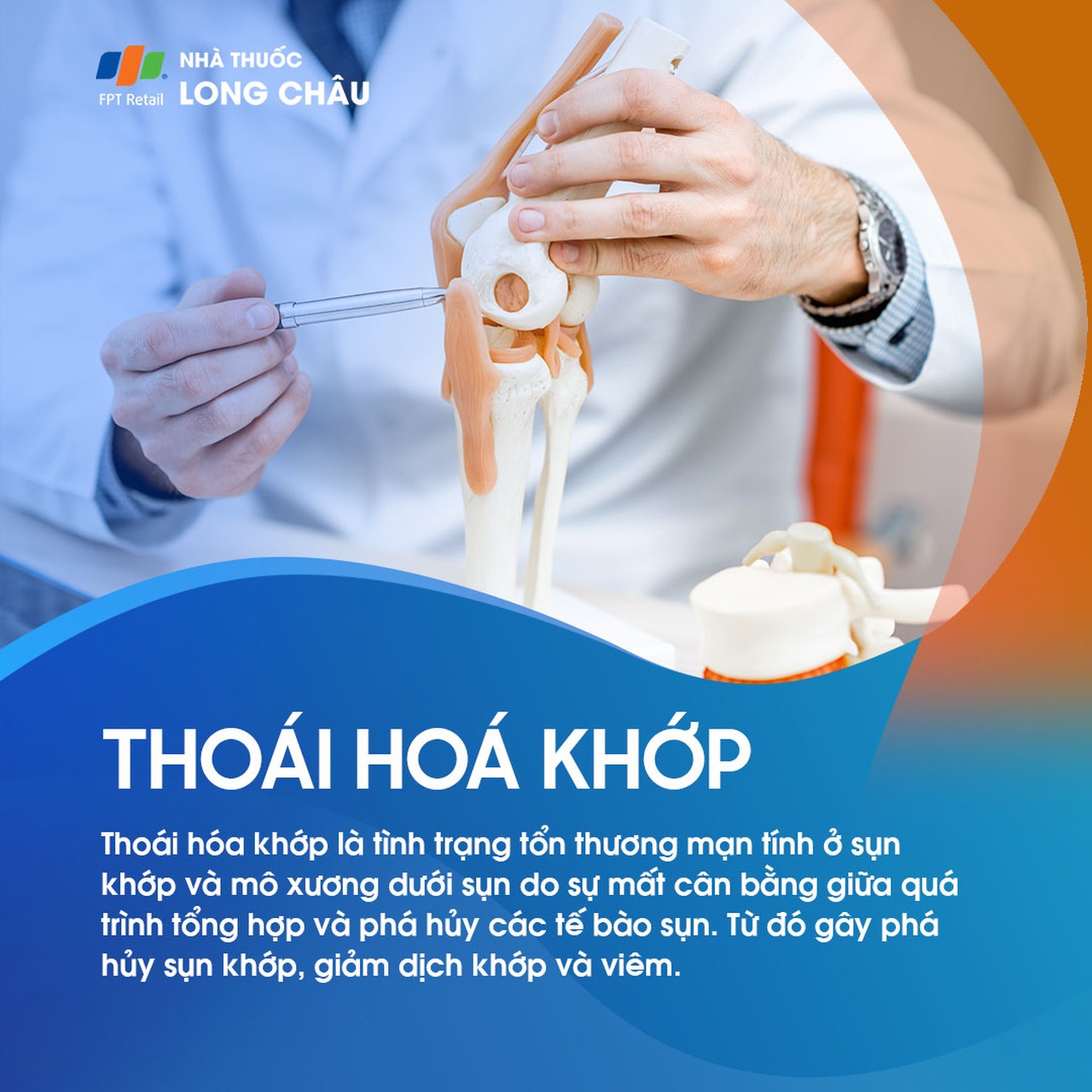 Thoái hóa khớp 1