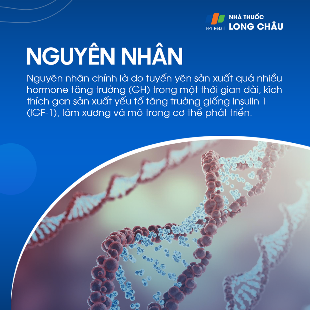 Bệnh to các viễn cực 4