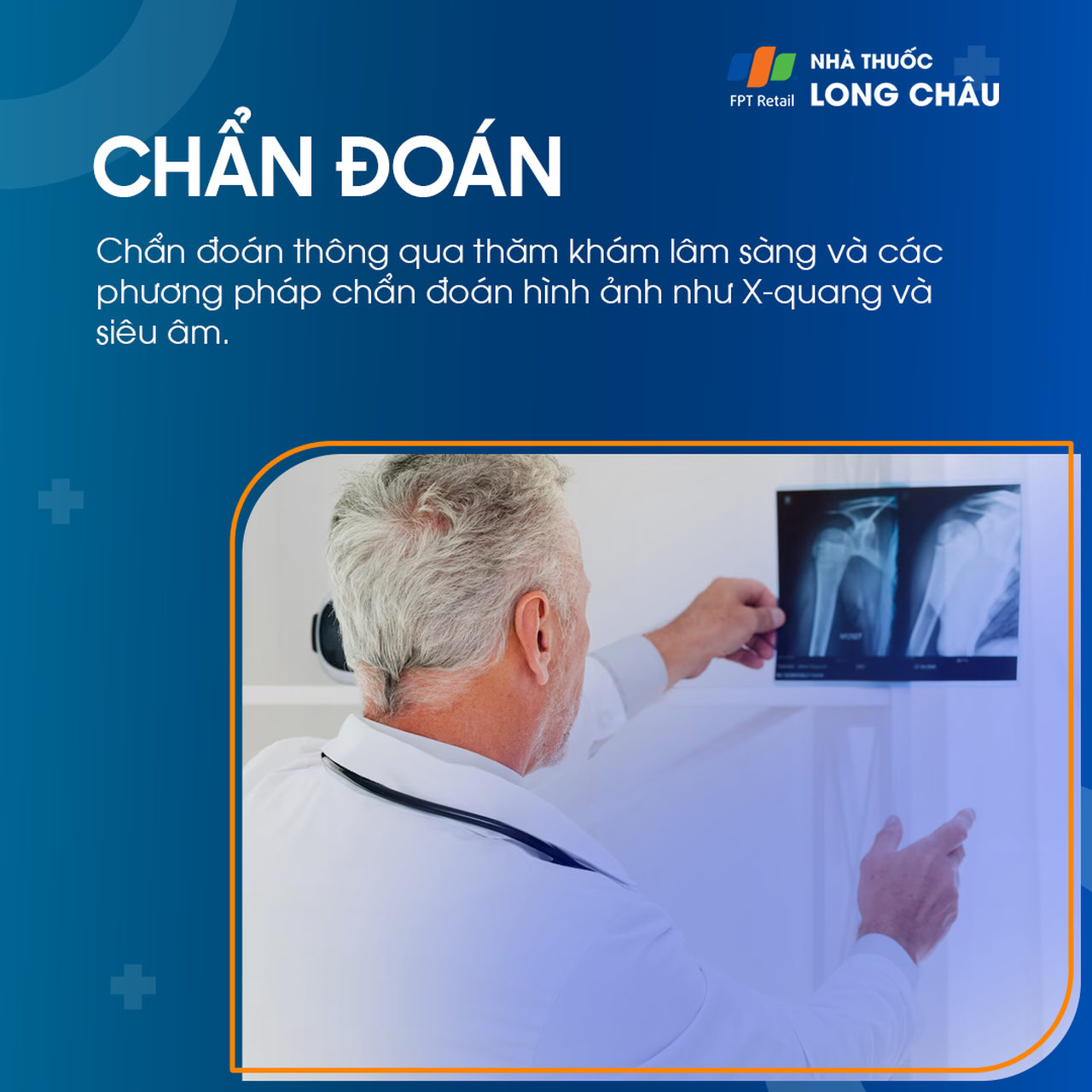 Trật khớp cùng đòn 5