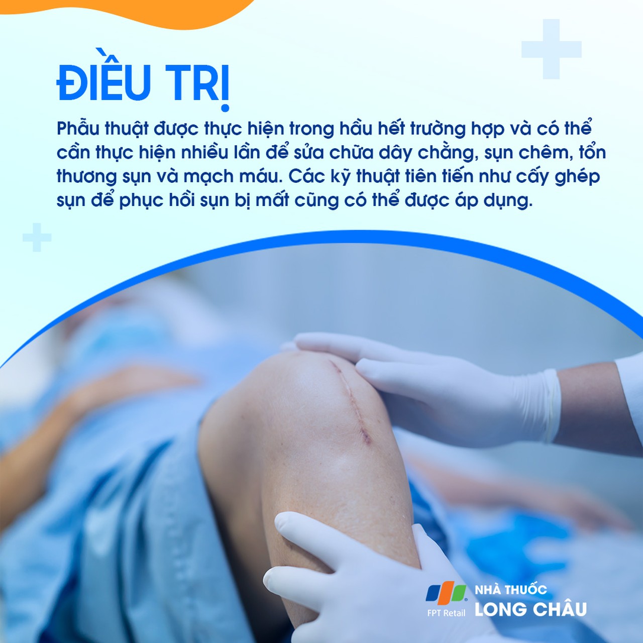 Trật khớp gối 8