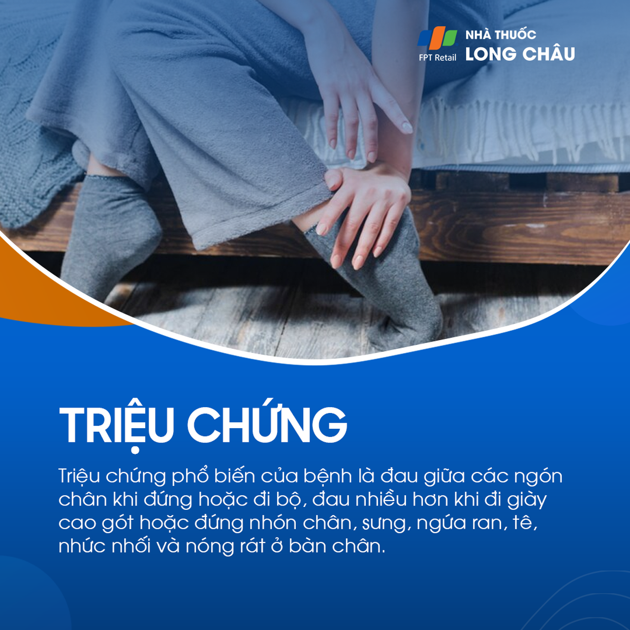 U dây thần kinh morton 2