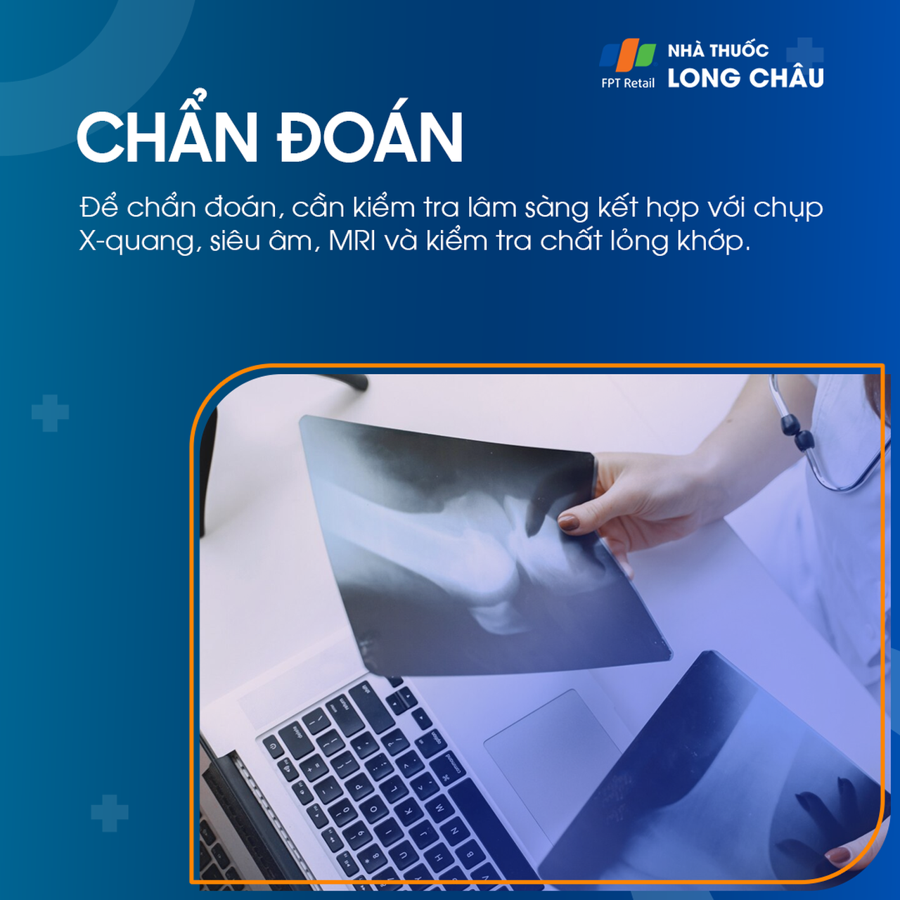 Viêm bao hoạt dịch khớp gối 5