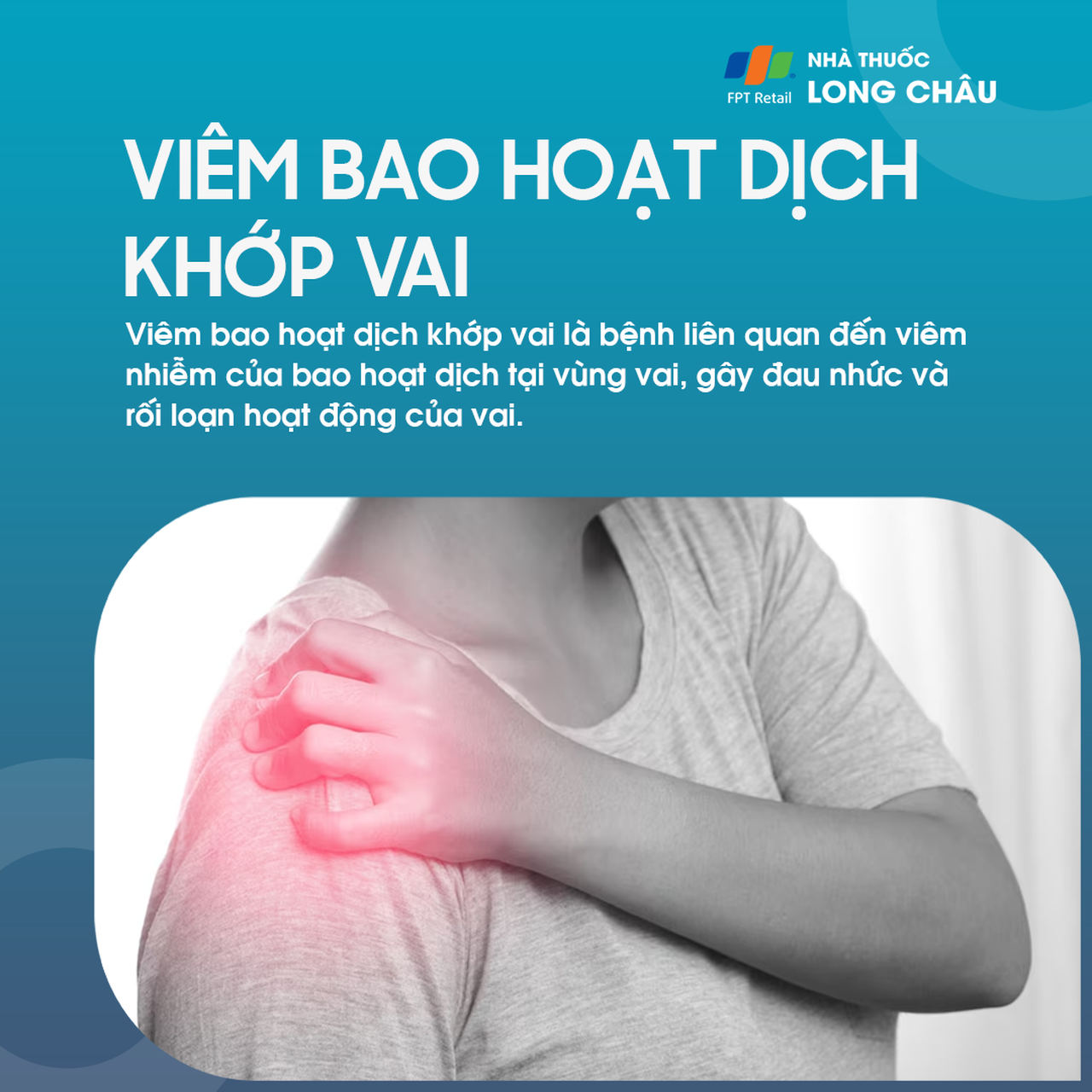 Viêm bao hoạt dịch khớp vai 2