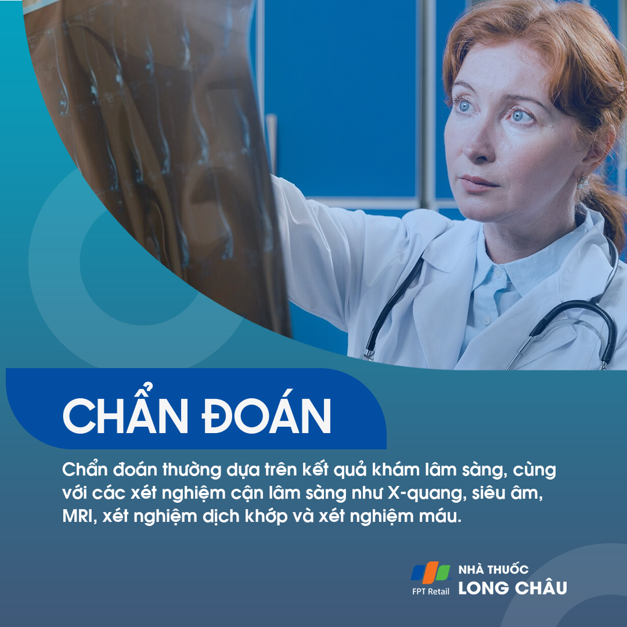 Bác sĩ chẩn đoán viêm bao hoạt dịch khớp vai qua phim X-quang