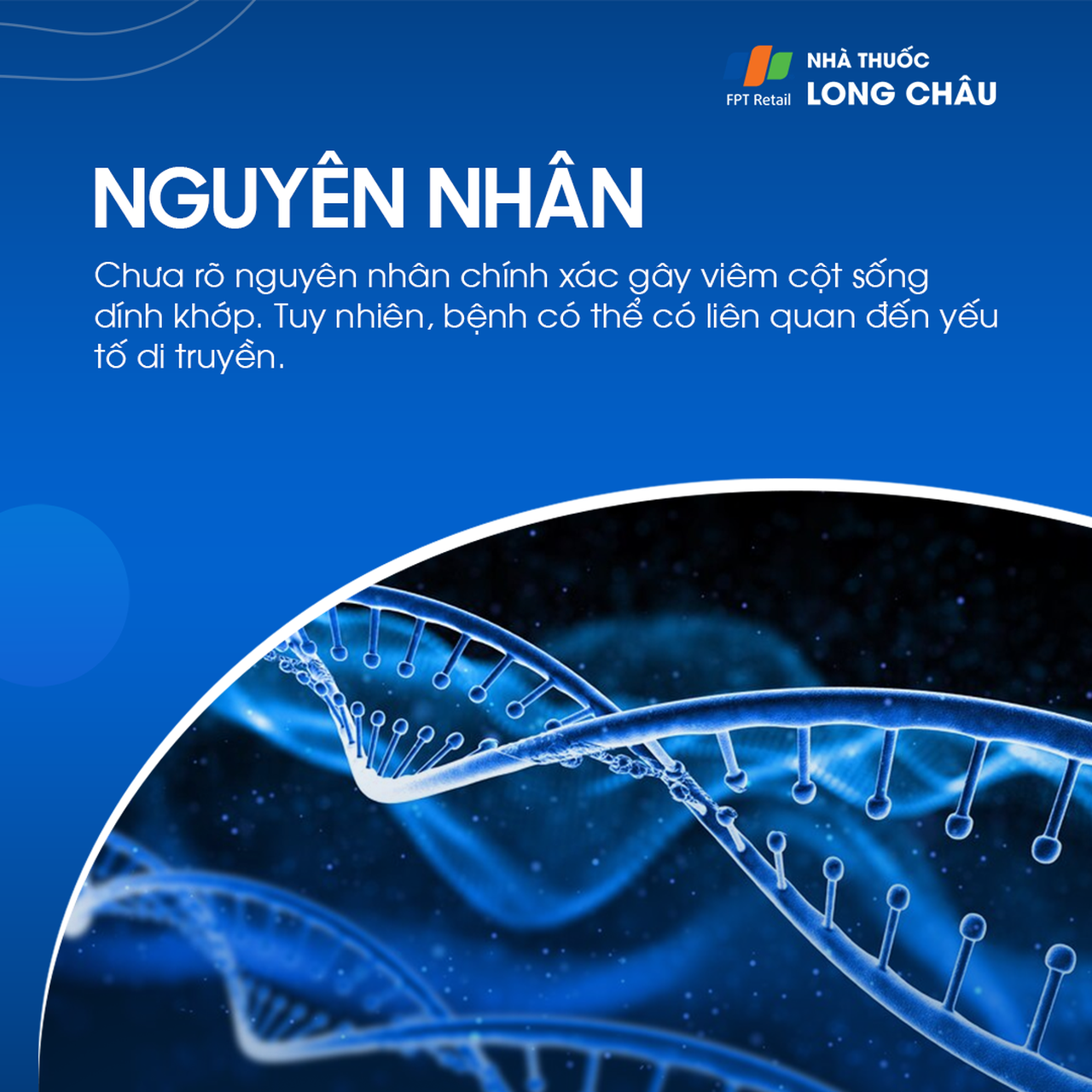 Viêm cột sống dính khớp 3